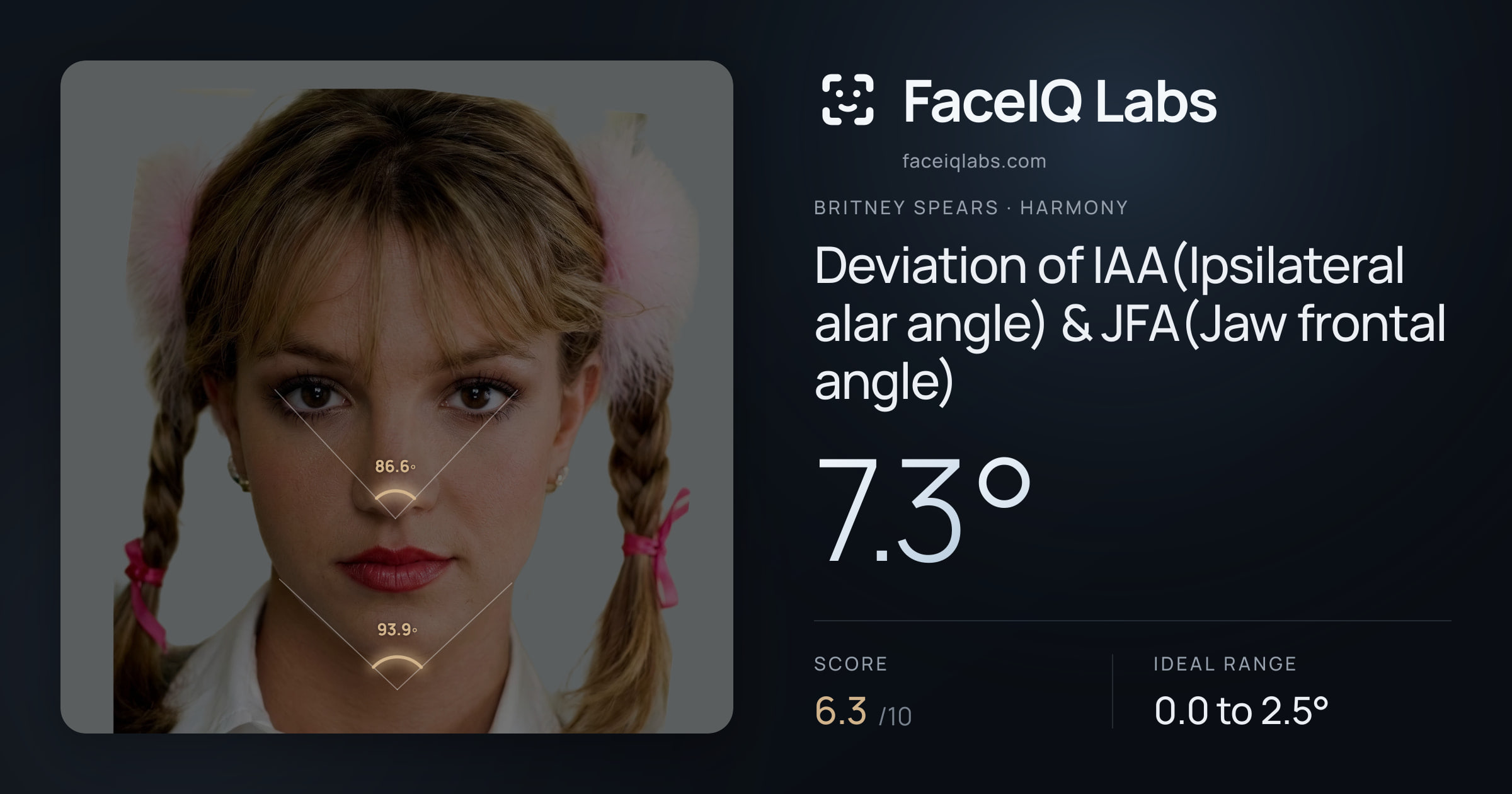 Britney Spears Deviation of IAA(Ipsilateral alar angle) & JFA(Jaw frontal angle): 7.3°, drawn on the photo