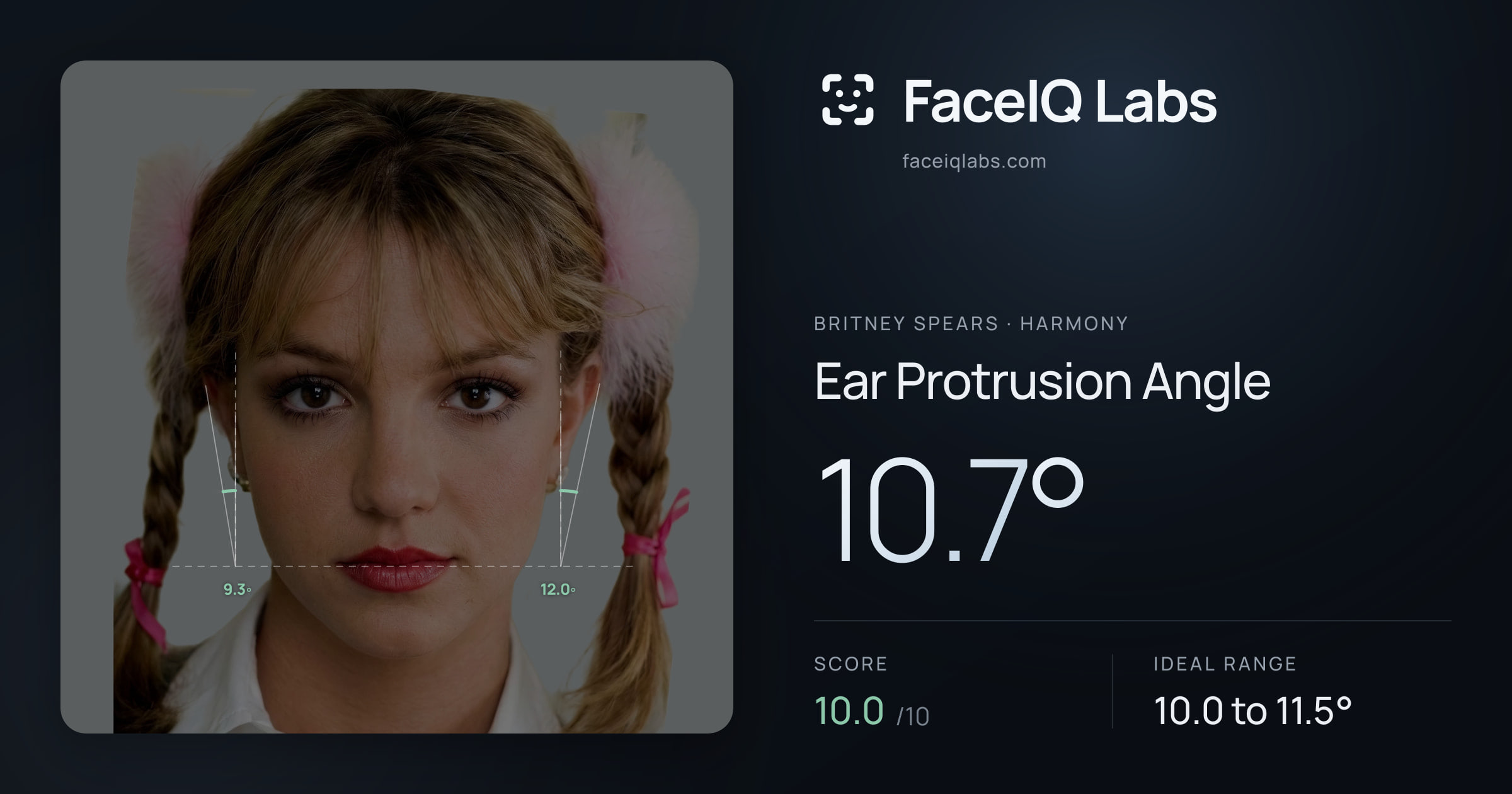 Britney Spears Ear Protrusion Angle: 10.7°, drawn on the photo