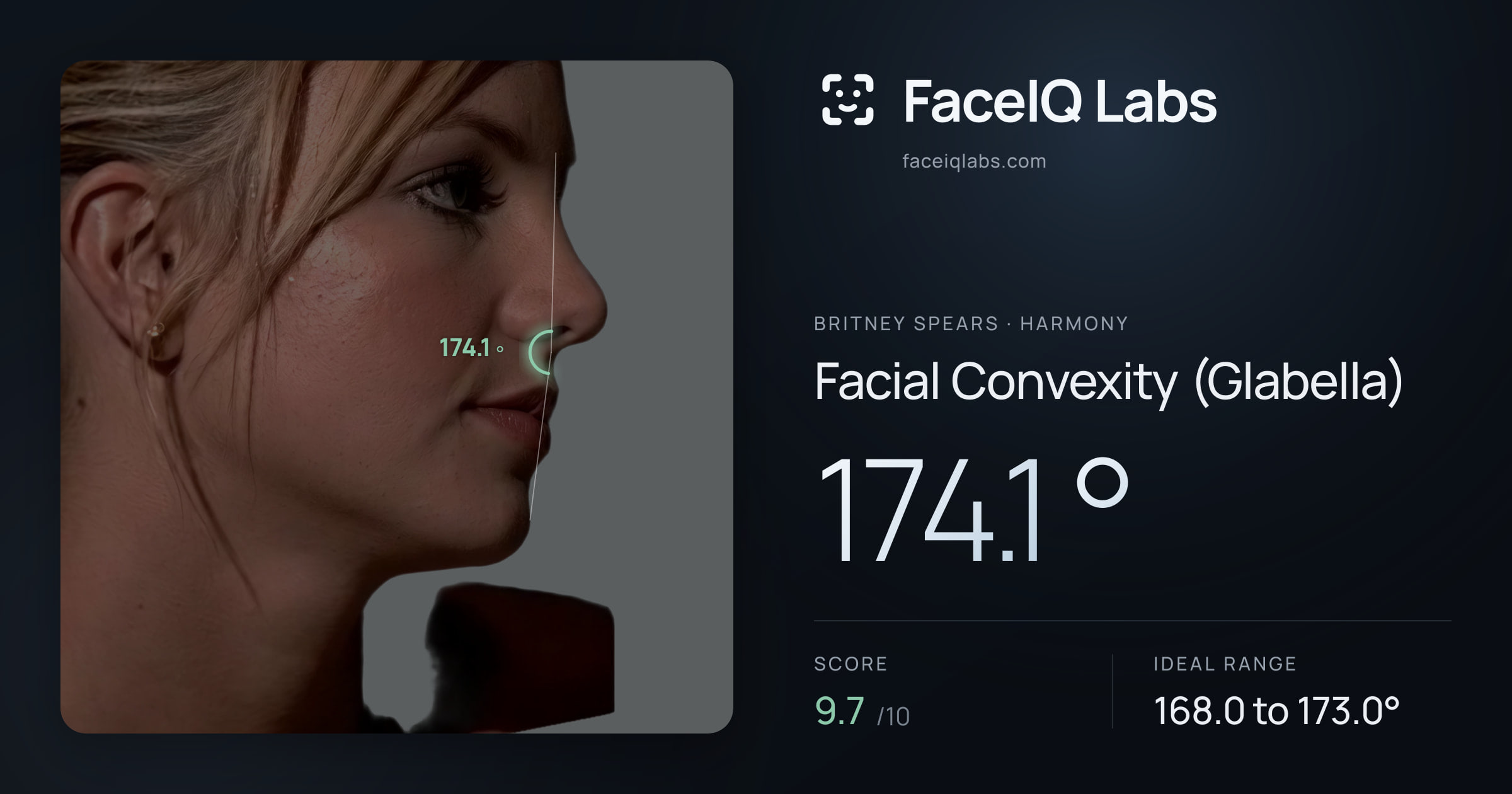Britney Spears Facial Convexity (Glabella): 174.1°, drawn on the photo