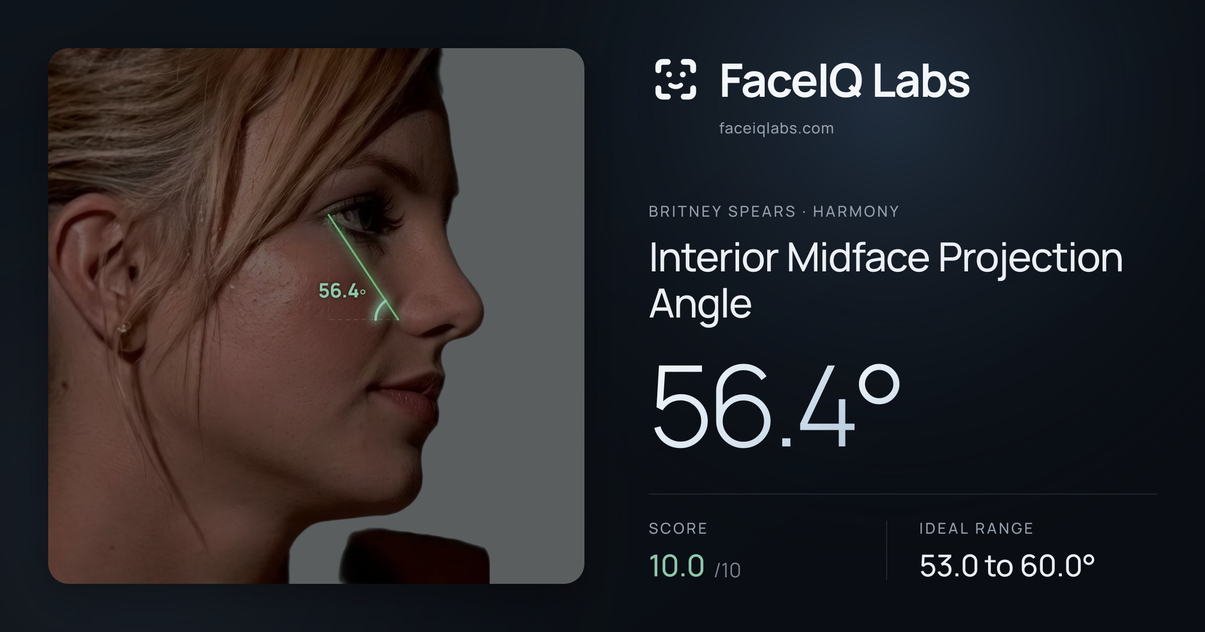 Britney Spears Interior Midface Projection Angle: 56.4°, drawn on the photo