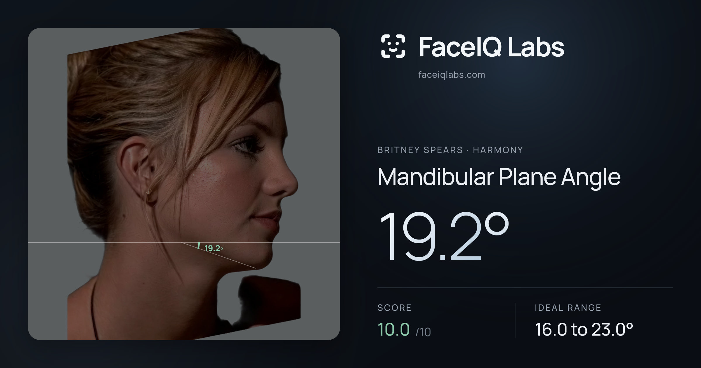Britney Spears Mandibular Plane Angle: 19.2°, drawn on the photo