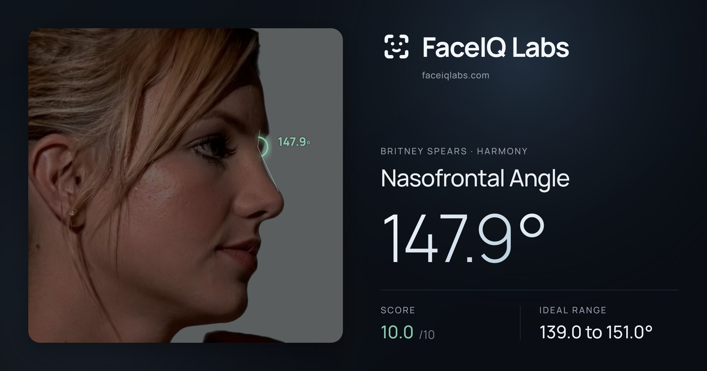 Britney Spears Nasofrontal Angle: 147.9°, drawn on the photo