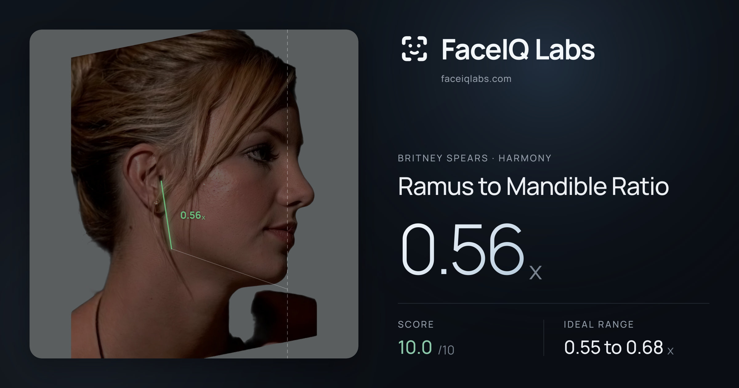 Britney Spears Ramus to Mandible Ratio: 0.56x, drawn on the photo
