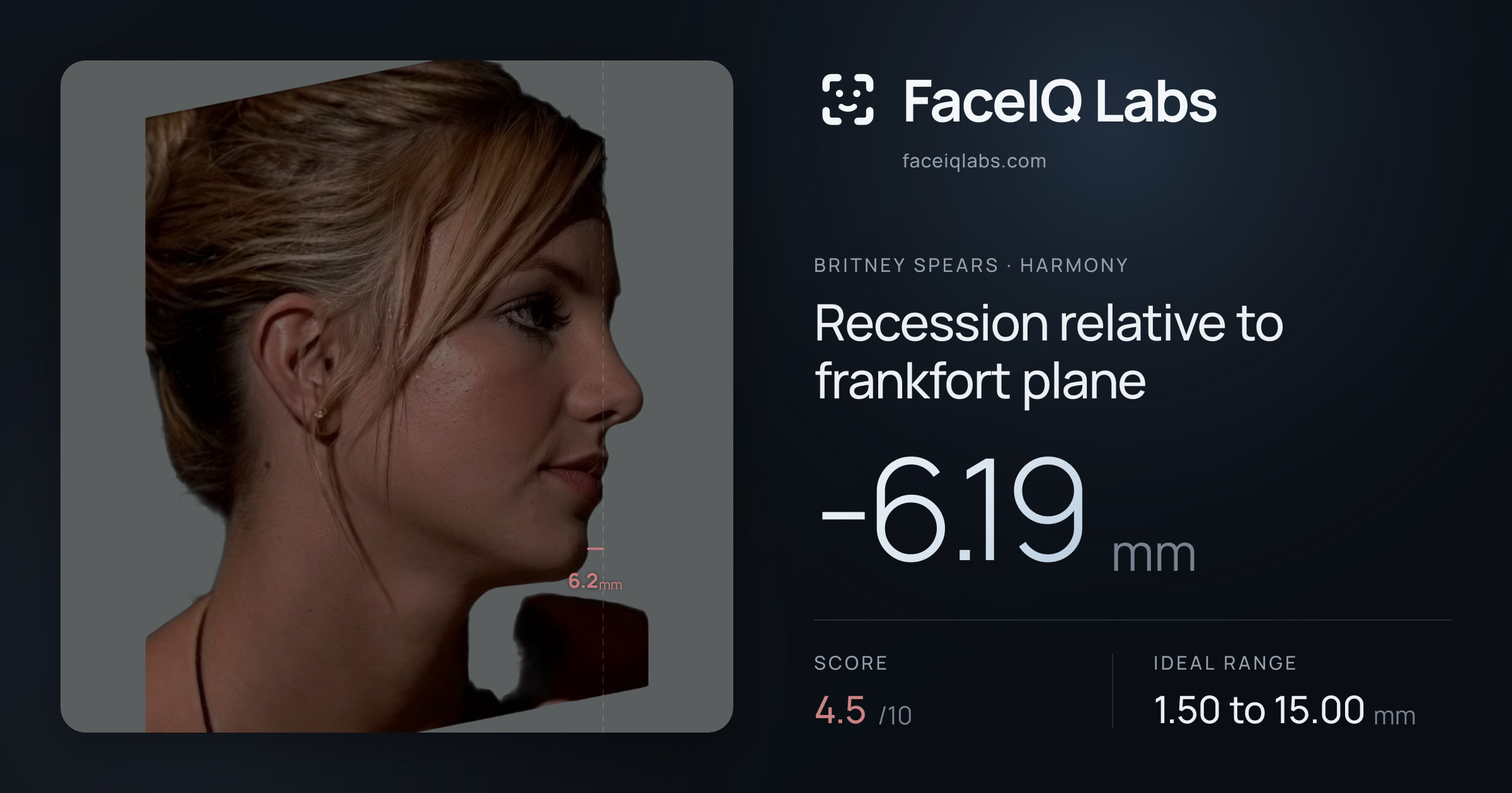 Britney Spears Recession relative to frankfort plane: -6.19mm, drawn on the photo