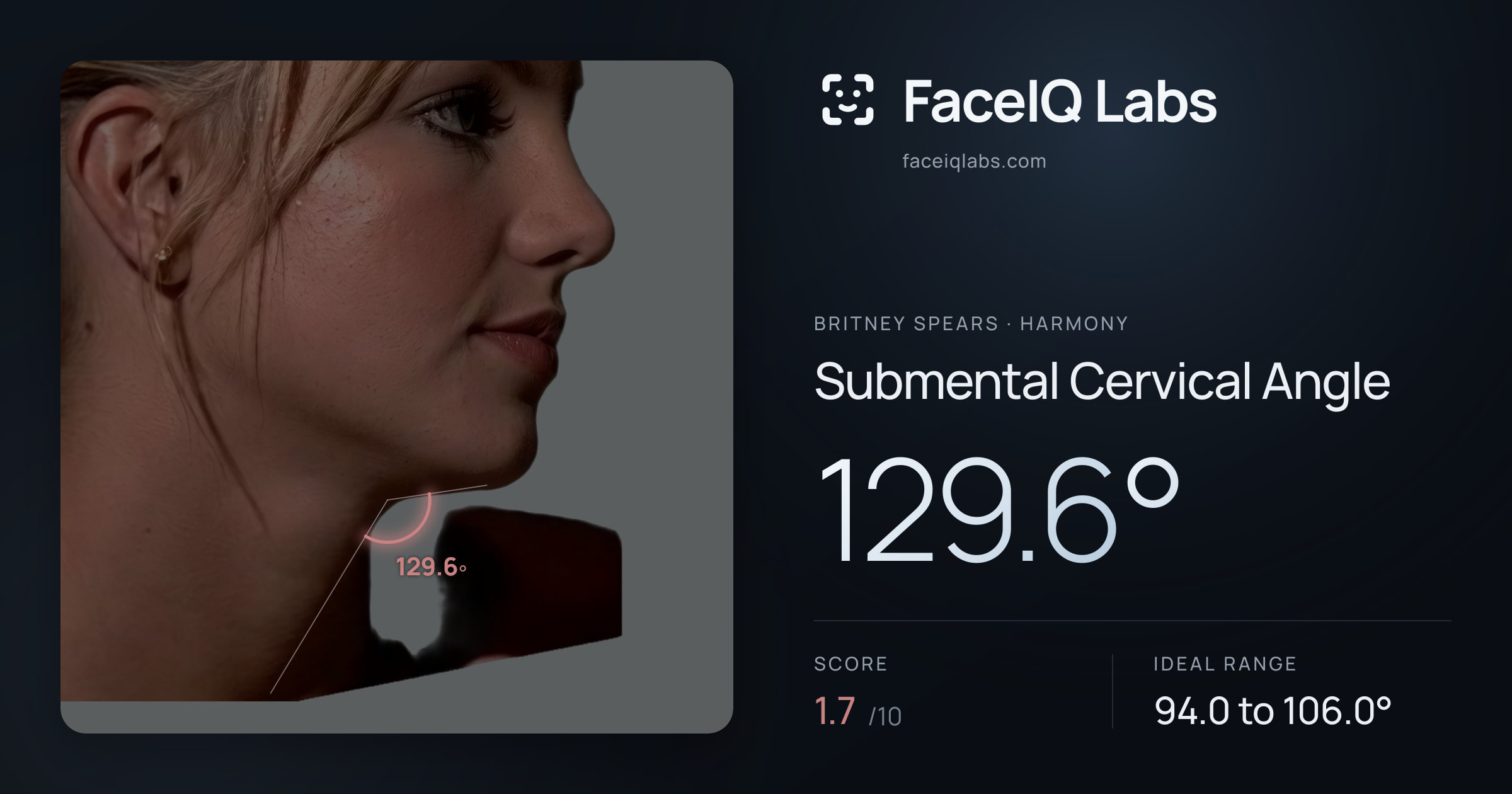 Britney Spears Submental Cervical Angle: 129.6°, drawn on the photo