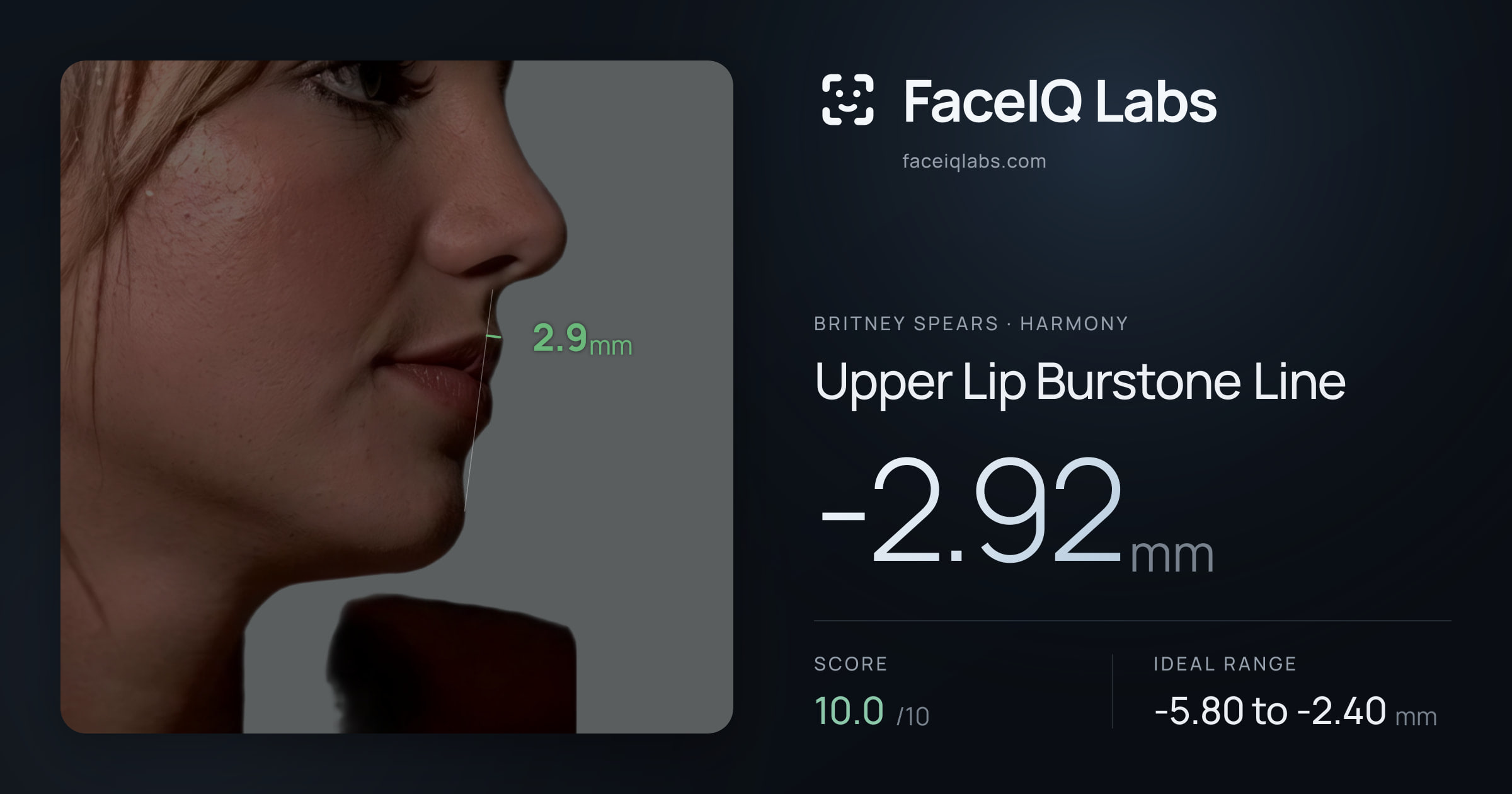 Britney Spears Upper Lip Burstone Line: -2.92mm, drawn on the photo