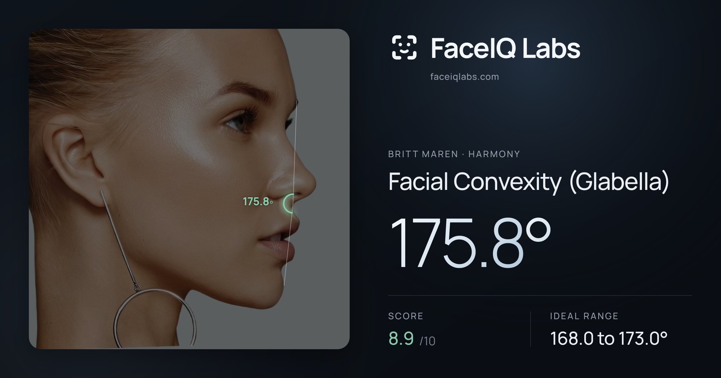 Britt Maren Facial Convexity (Glabella): 175.8°, drawn on the photo