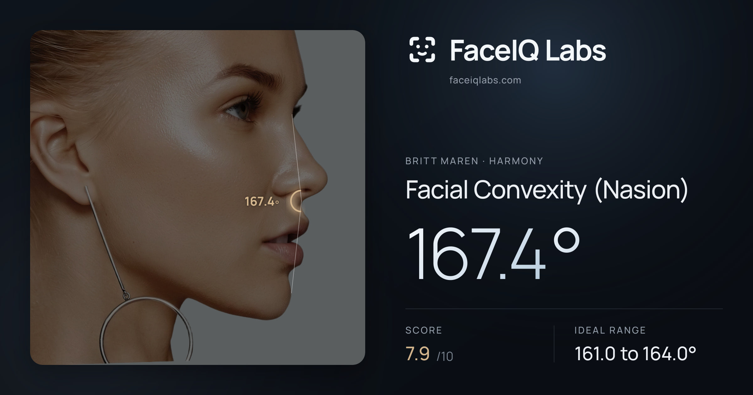 Britt Maren Facial Convexity (Nasion): 167.4°, drawn on the photo