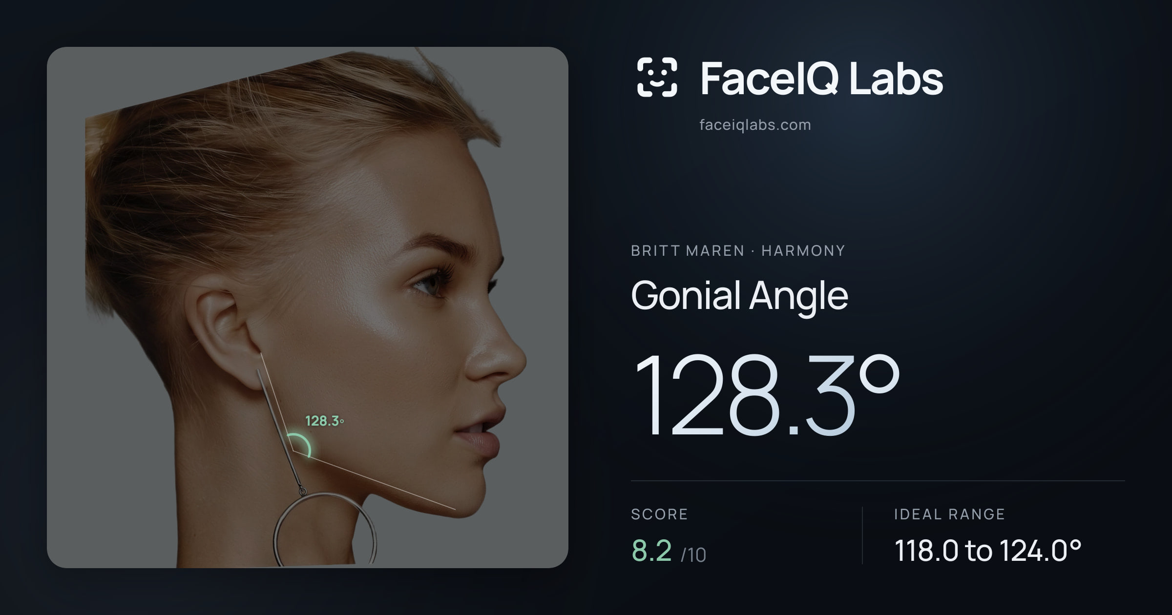 Britt Maren Gonial Angle: 128.3°, drawn on the photo