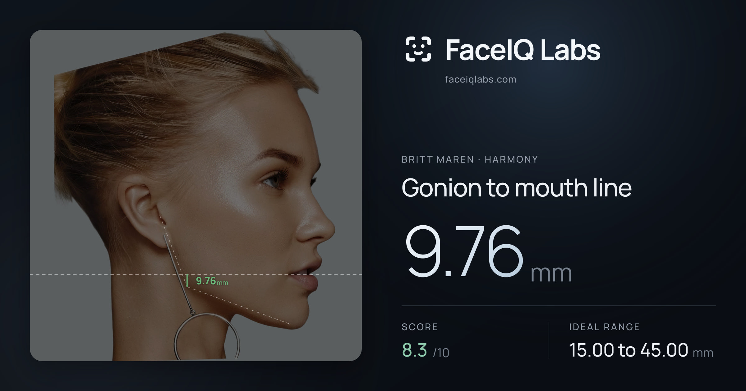 Britt Maren Gonion to mouth line: 9.76mm, drawn on the photo