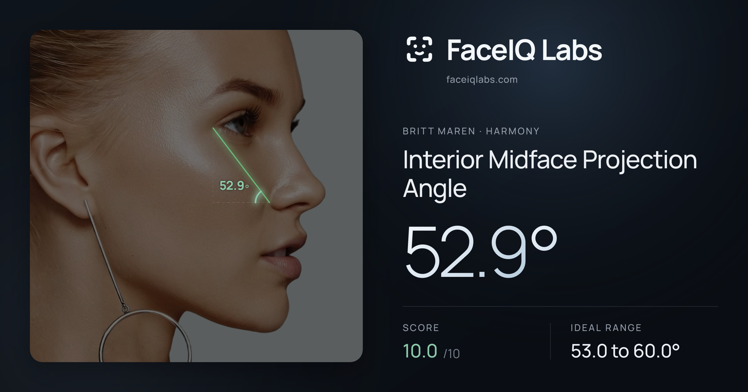 Britt Maren Interior Midface Projection Angle: 52.9°, drawn on the photo