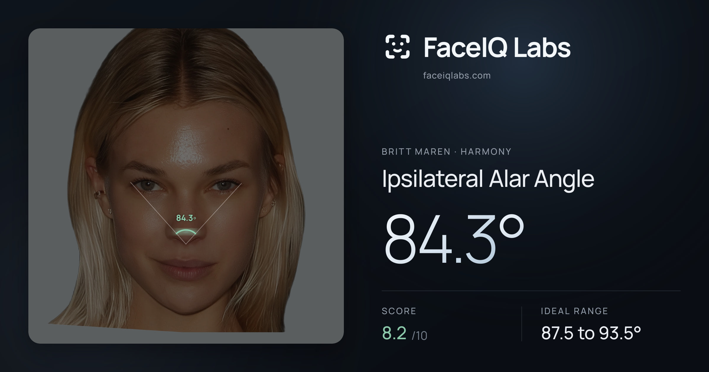 Britt Maren Ipsilateral Alar Angle: 84.3°, drawn on the photo