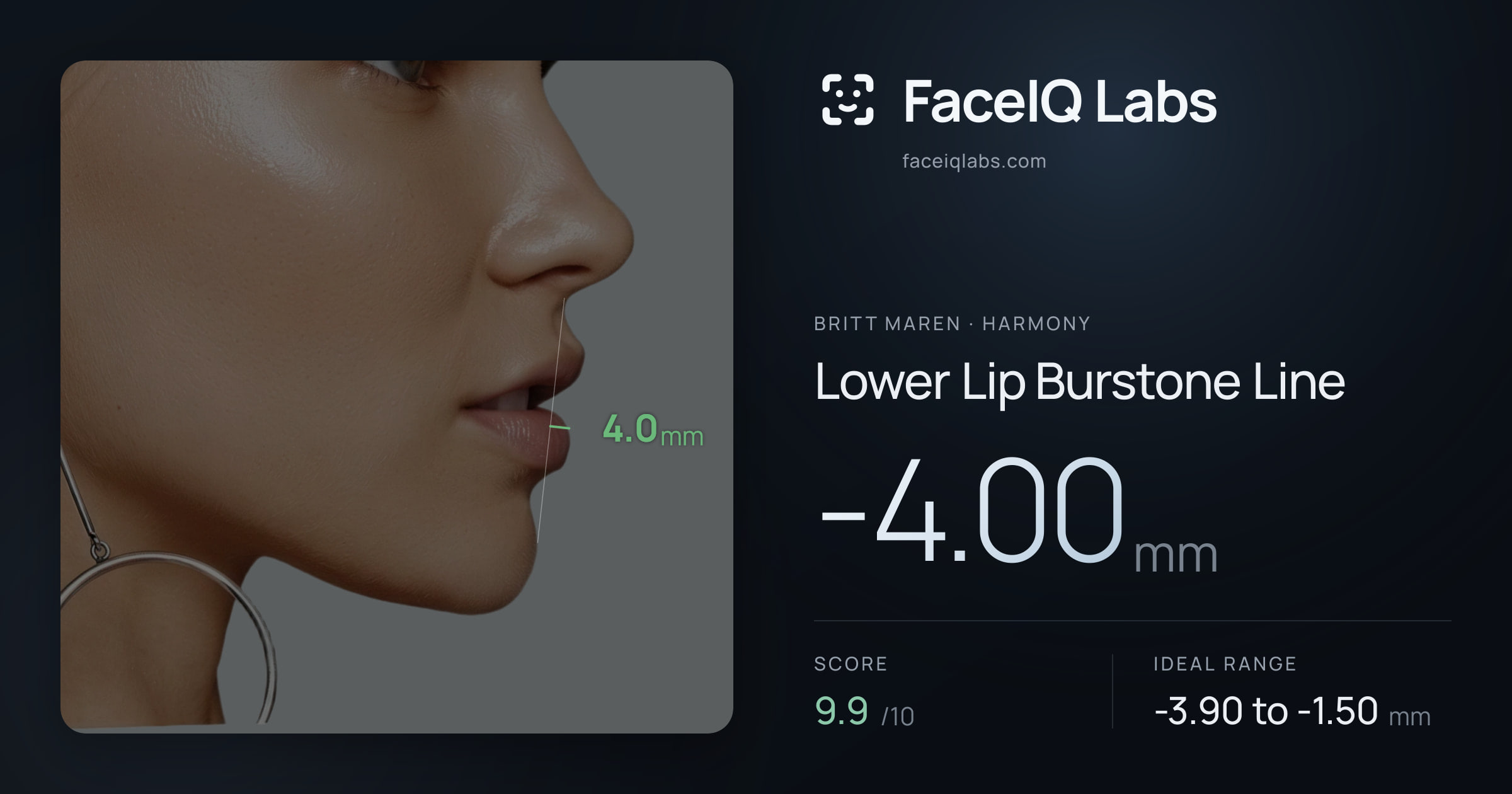 Britt Maren Lower Lip Burstone Line: -4.00mm, drawn on the photo