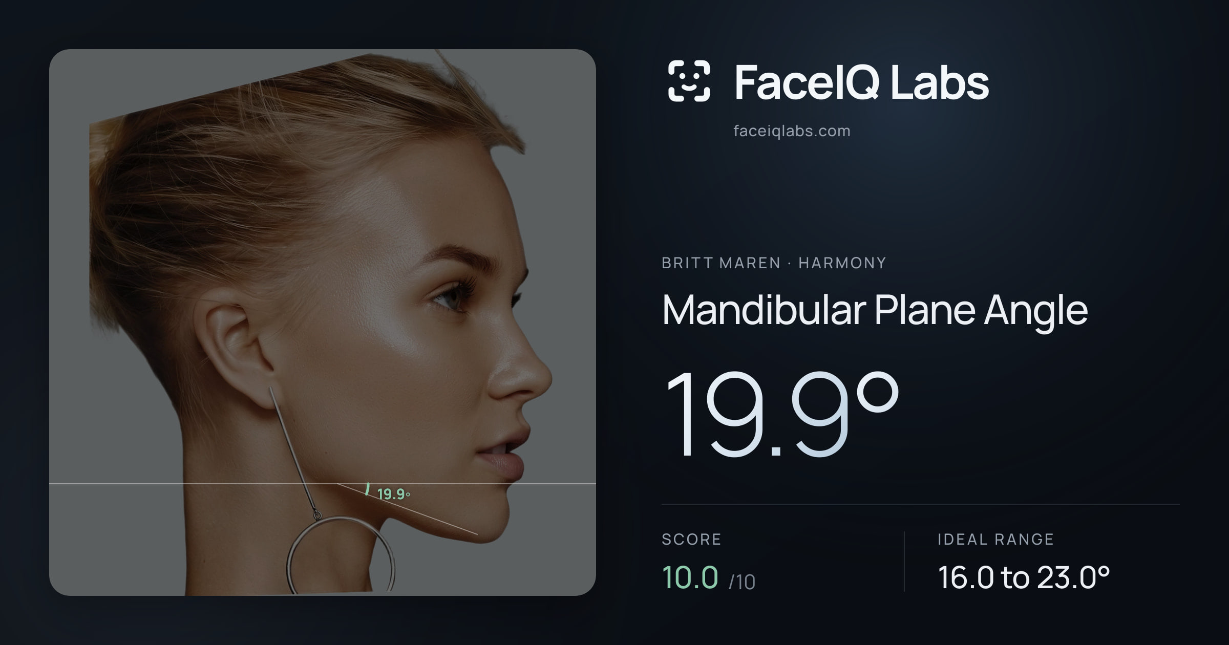 Britt Maren Mandibular Plane Angle: 19.9°, drawn on the photo