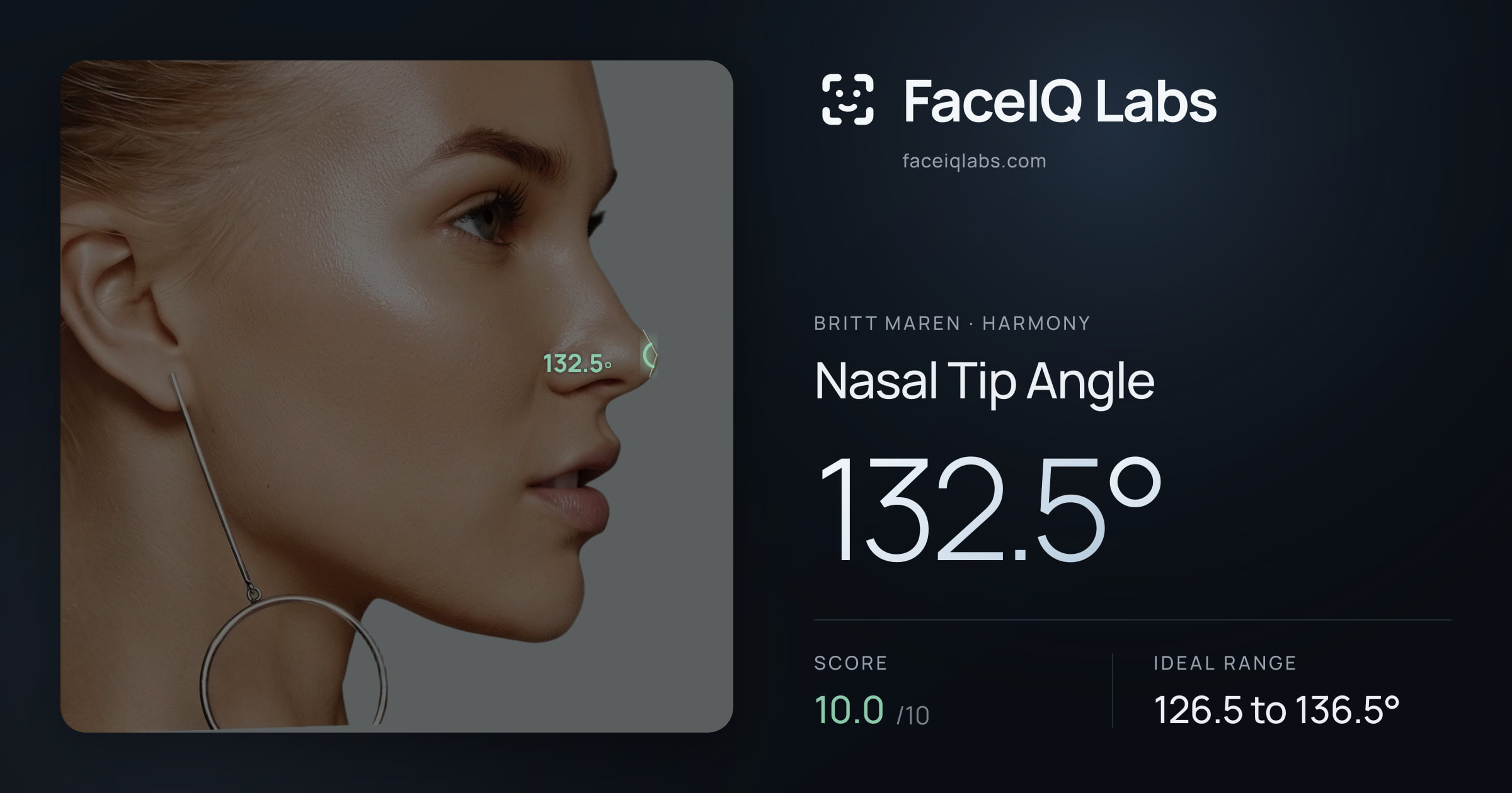 Britt Maren Nasal Tip Angle: 132.5°, drawn on the photo