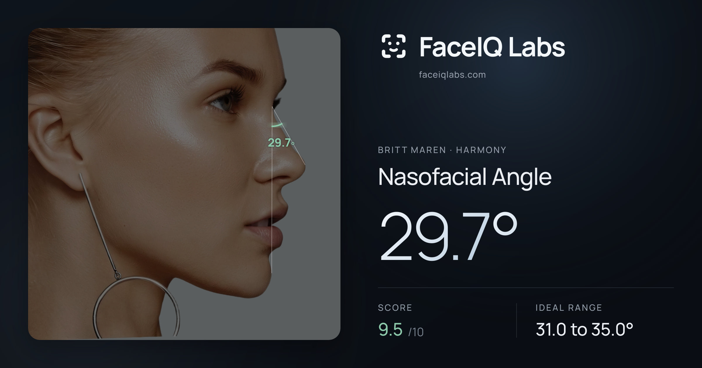 Britt Maren Nasofacial Angle: 29.7°, drawn on the photo