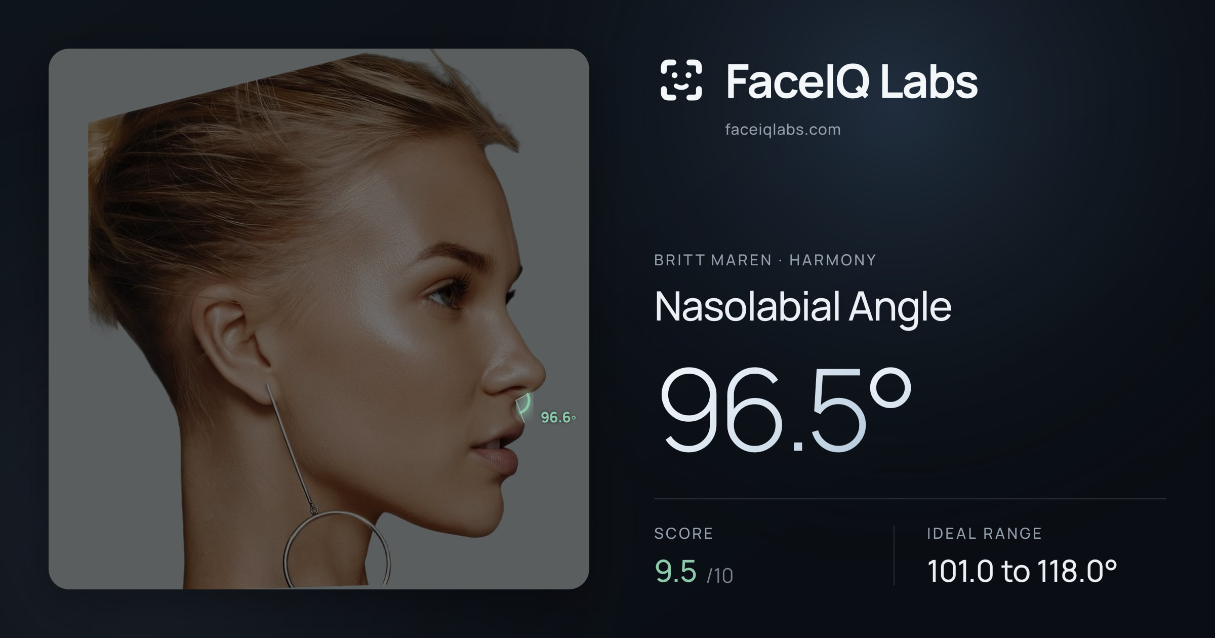 Britt Maren Nasolabial Angle: 96.5°, drawn on the photo