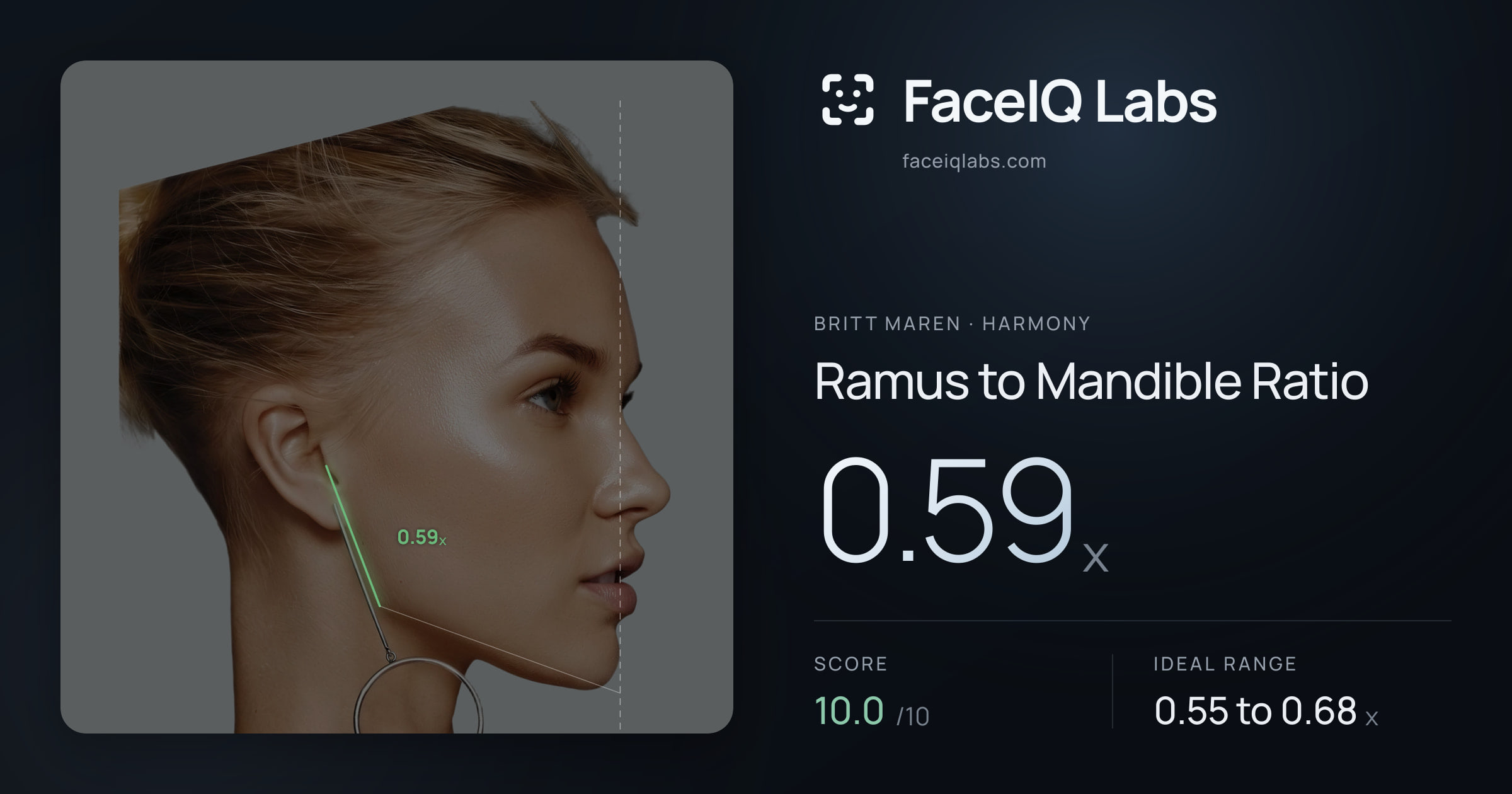 Britt Maren Ramus to Mandible Ratio: 0.59x, drawn on the photo