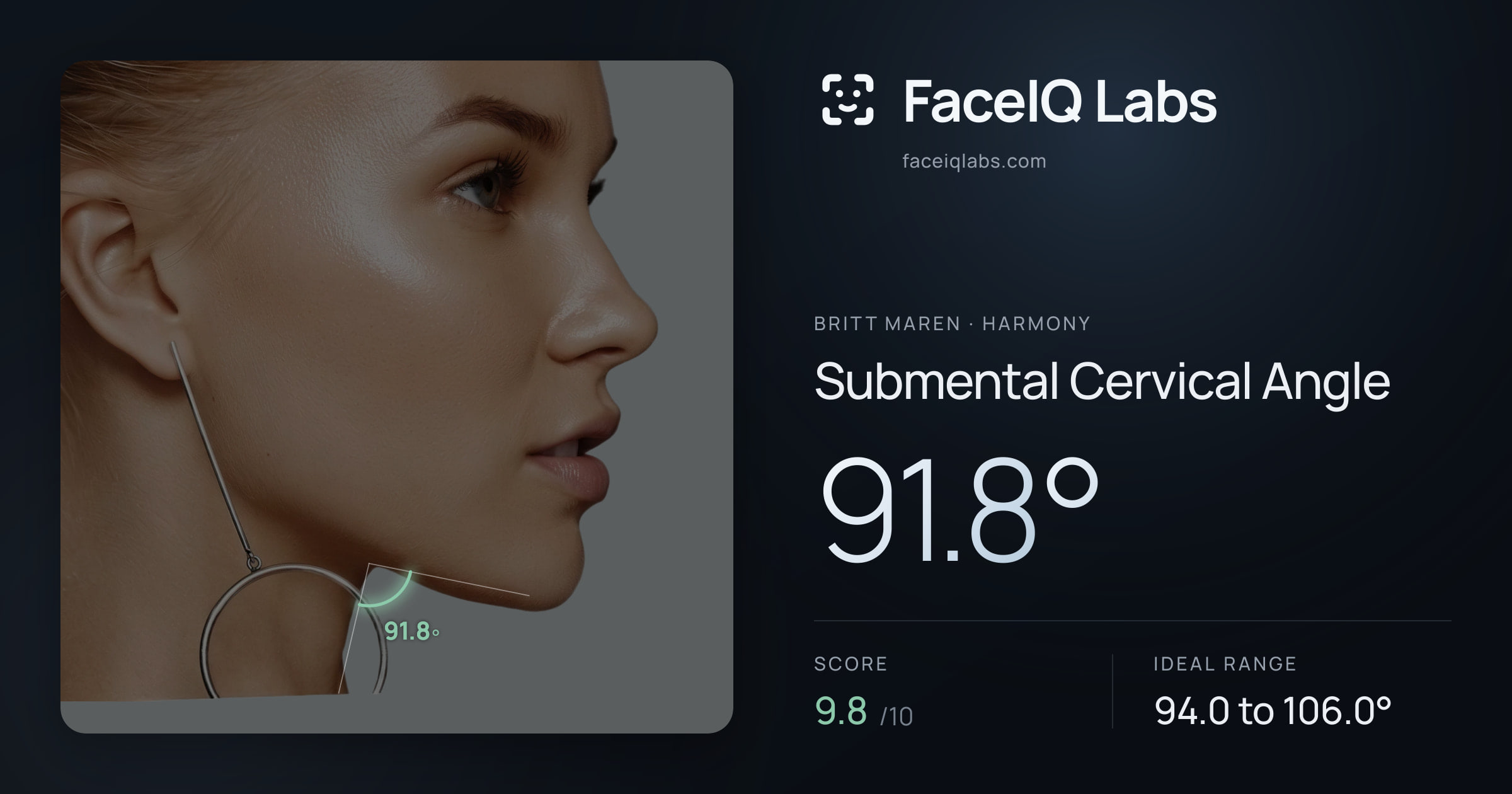 Britt Maren Submental Cervical Angle: 91.8°, drawn on the photo
