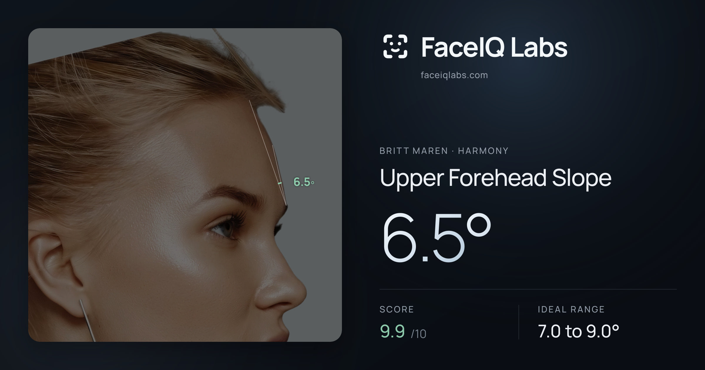 Britt Maren Upper Forehead Slope: 6.5°, drawn on the photo