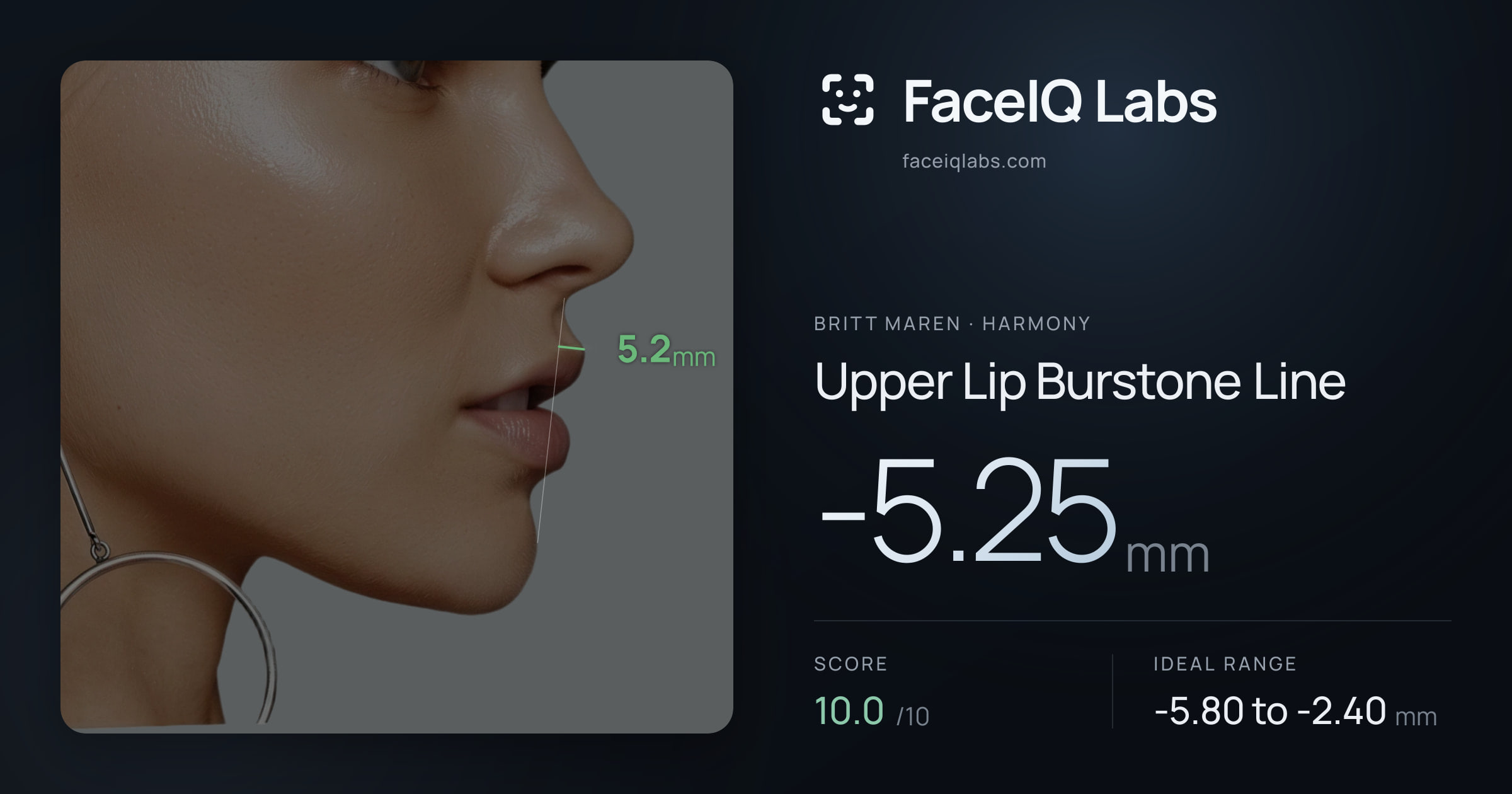 Britt Maren Upper Lip Burstone Line: -5.25mm, drawn on the photo