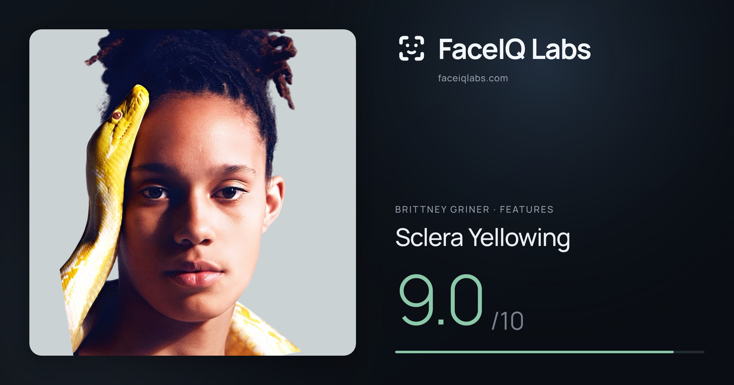Brittney Griner Sclera Yellowing: 9.0/10, drawn on the photo