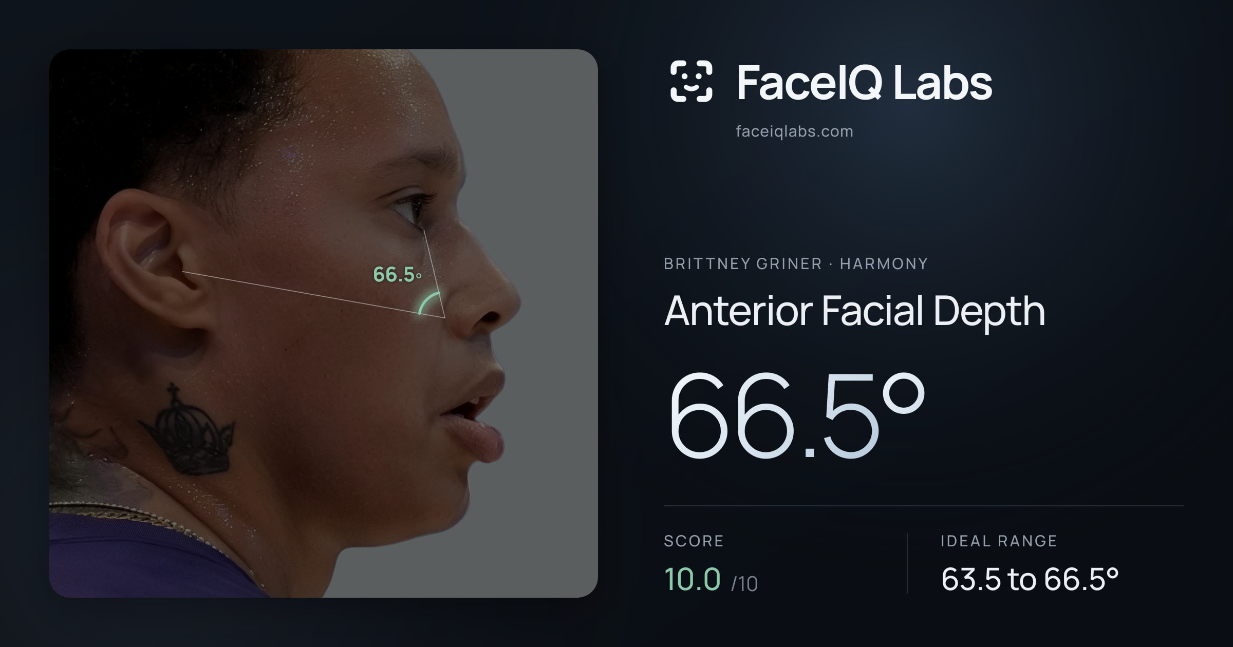 Brittney Griner Anterior Facial Depth: 66.5°, drawn on the photo