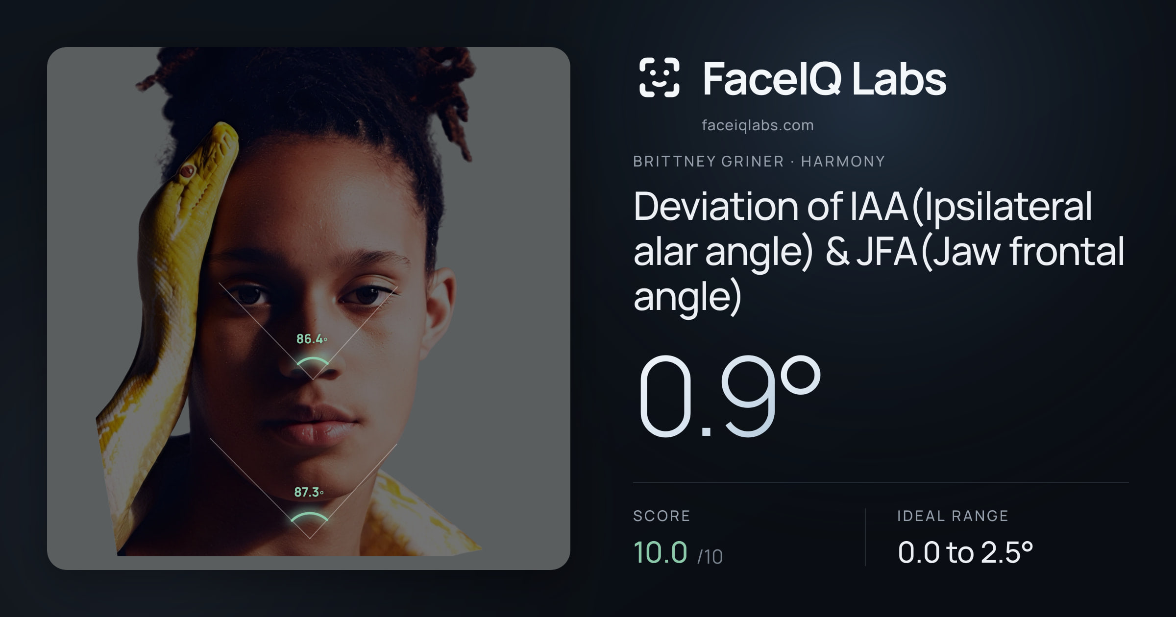 Brittney Griner Deviation of IAA(Ipsilateral alar angle) & JFA(Jaw frontal angle): 0.9°, drawn on the photo