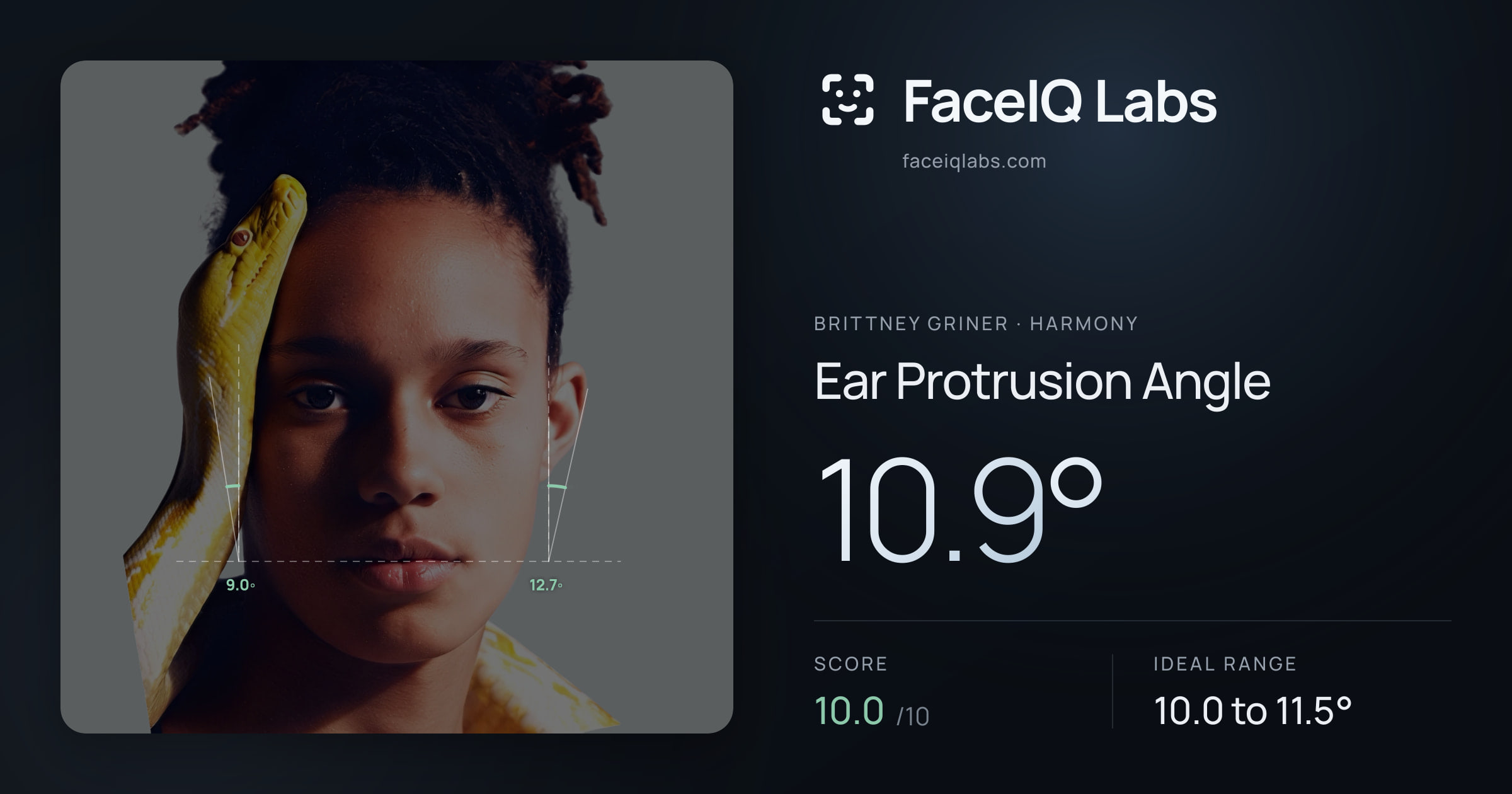 Brittney Griner Ear Protrusion Angle: 10.9°, drawn on the photo