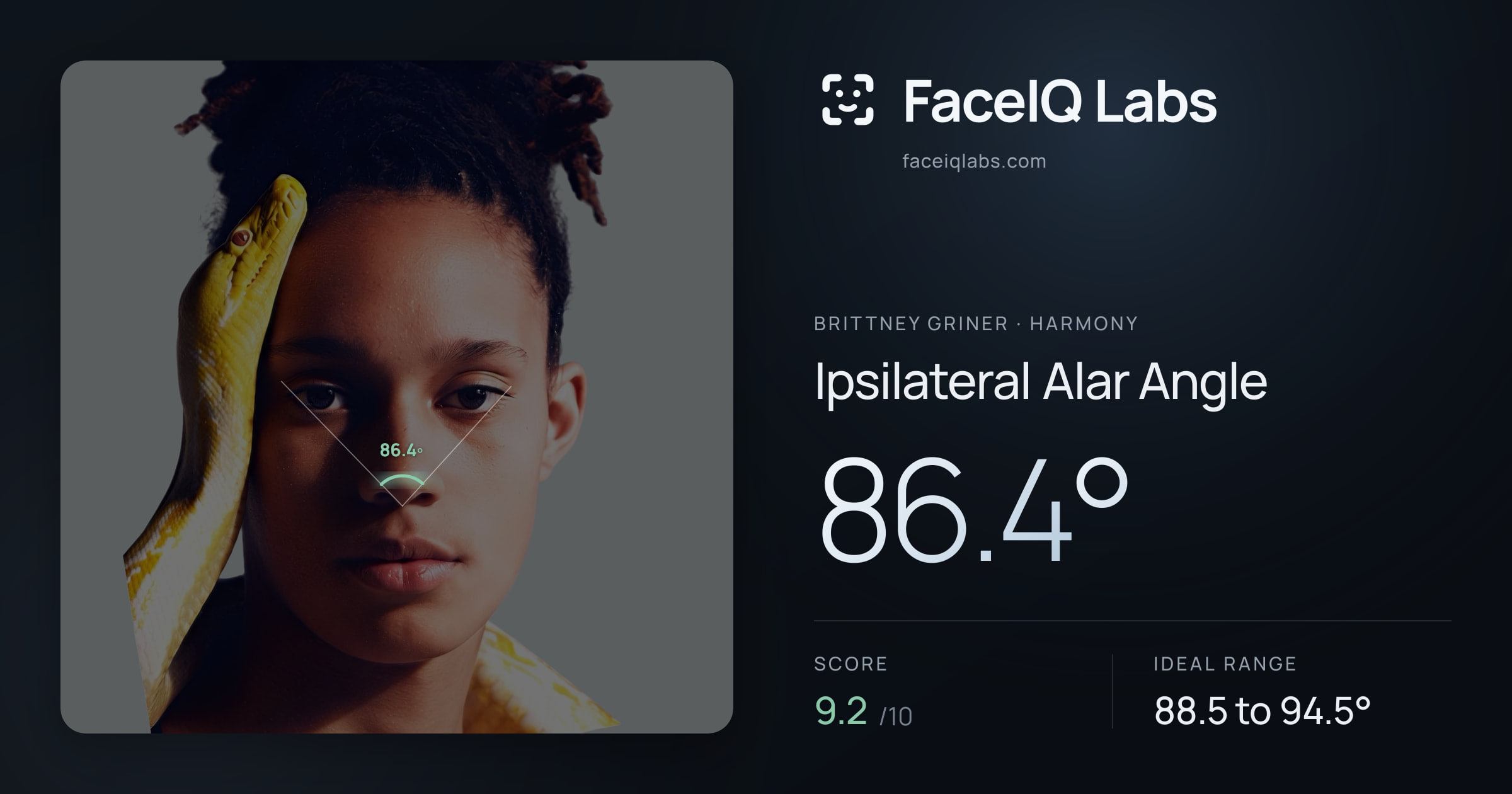 Brittney Griner Ipsilateral Alar Angle: 86.4°, drawn on the photo