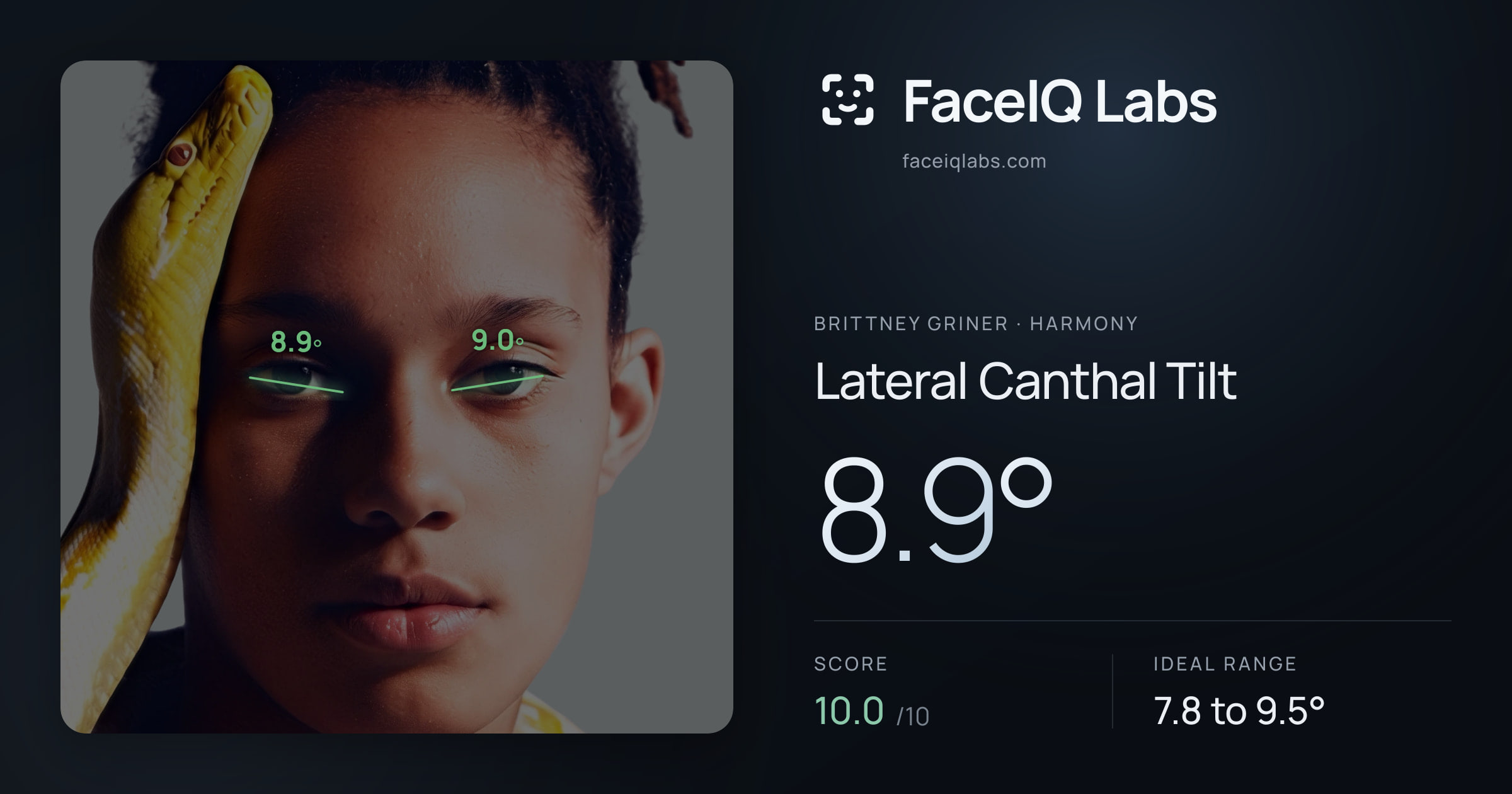 Brittney Griner Lateral Canthal Tilt: 8.9°, drawn on the photo