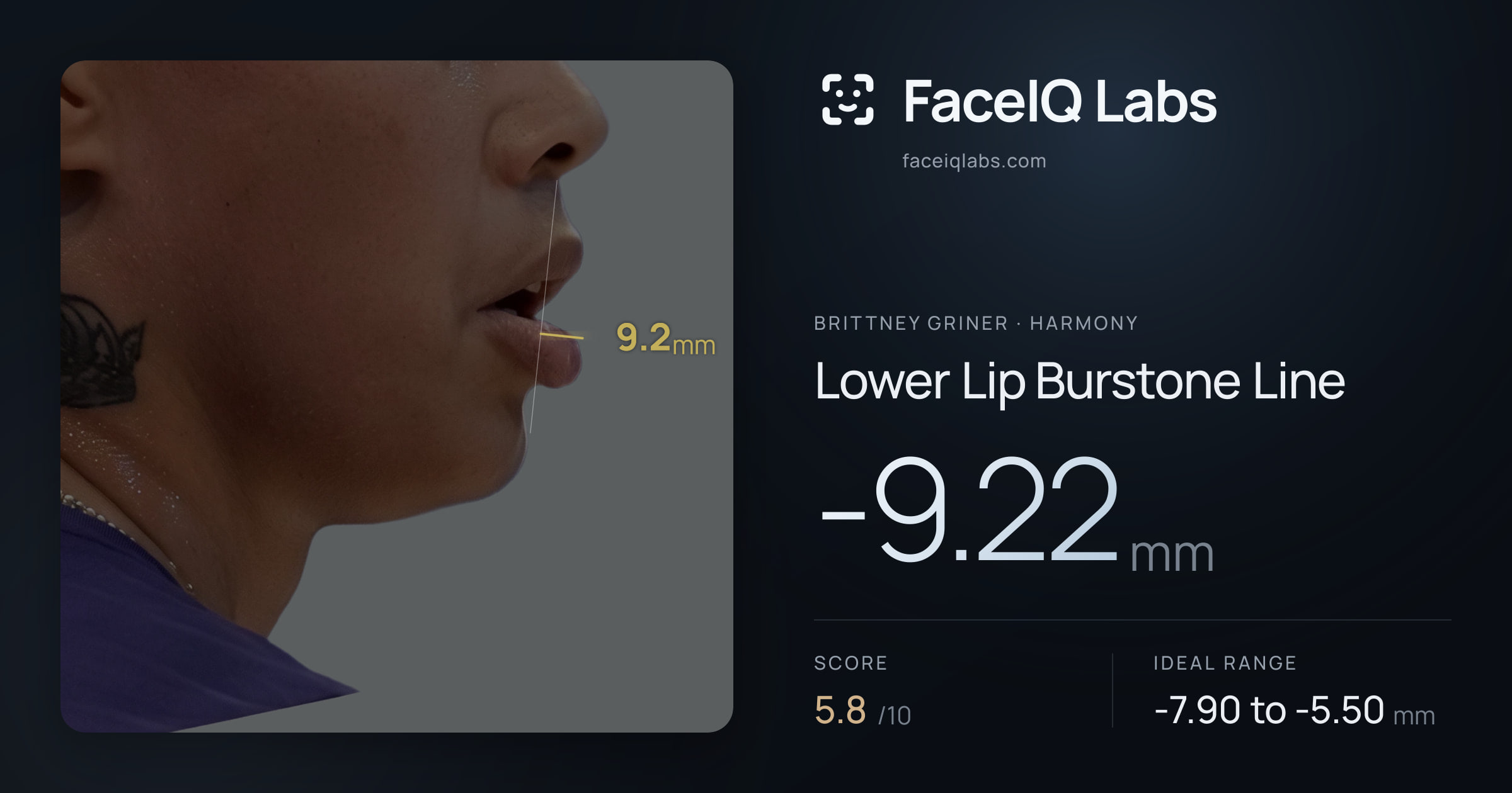 Brittney Griner Lower Lip Burstone Line: -9.22mm, drawn on the photo