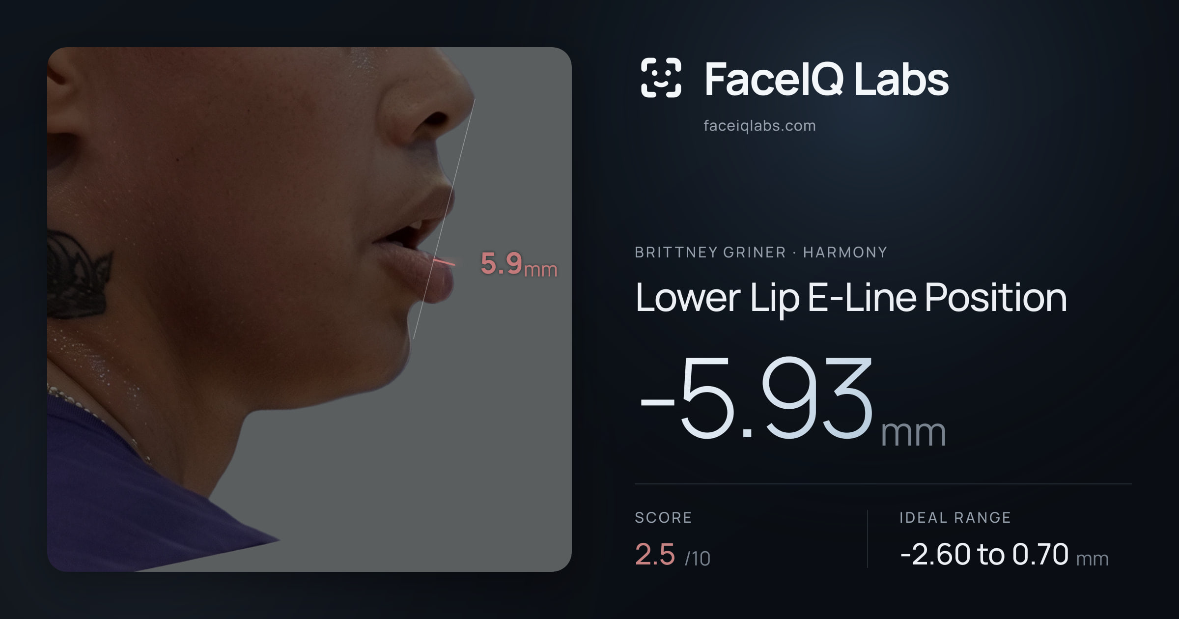 Brittney Griner Lower Lip E-Line Position: -5.93mm, drawn on the photo
