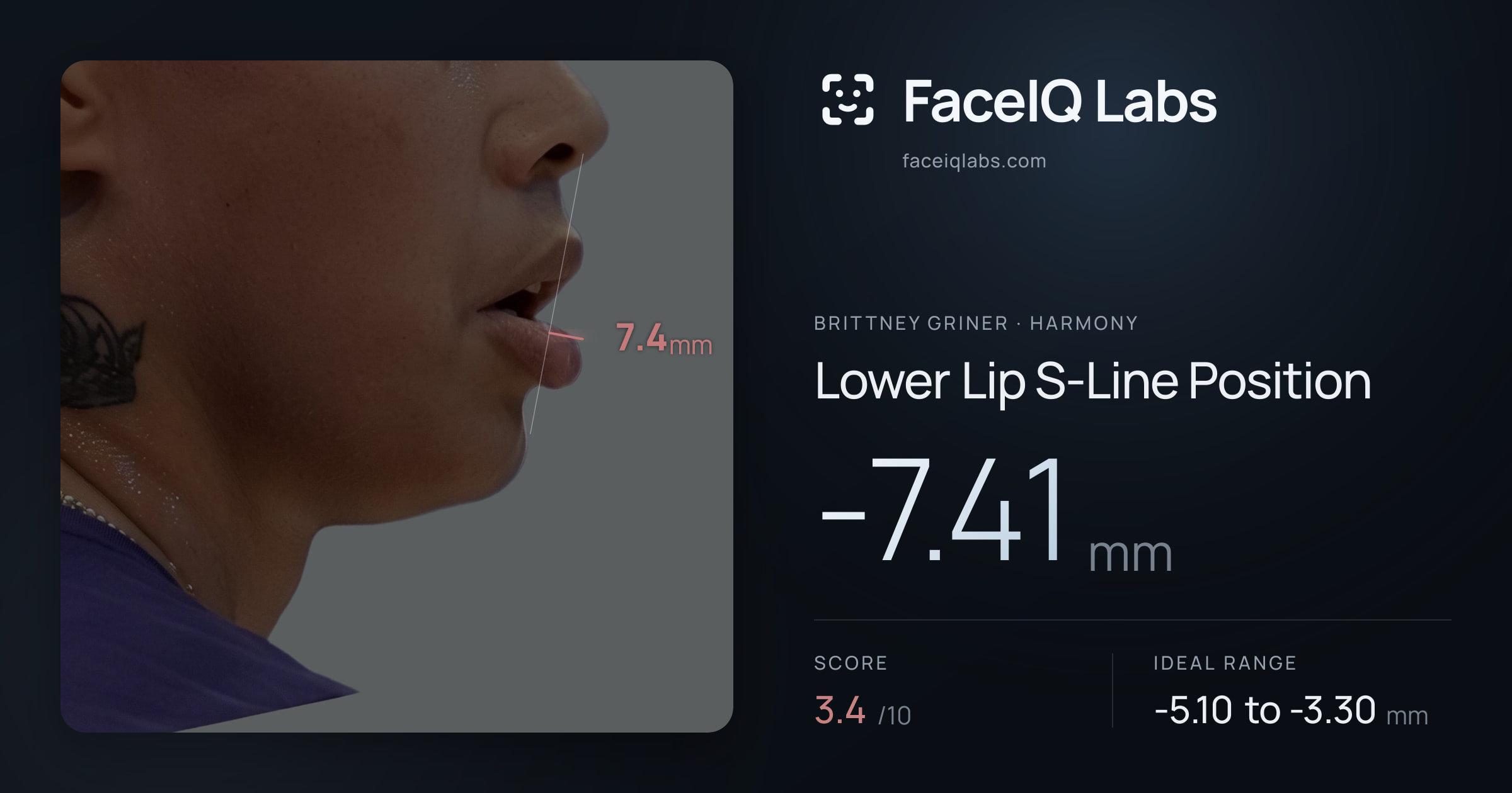 Brittney Griner Lower Lip S-Line Position: -7.41mm, drawn on the photo