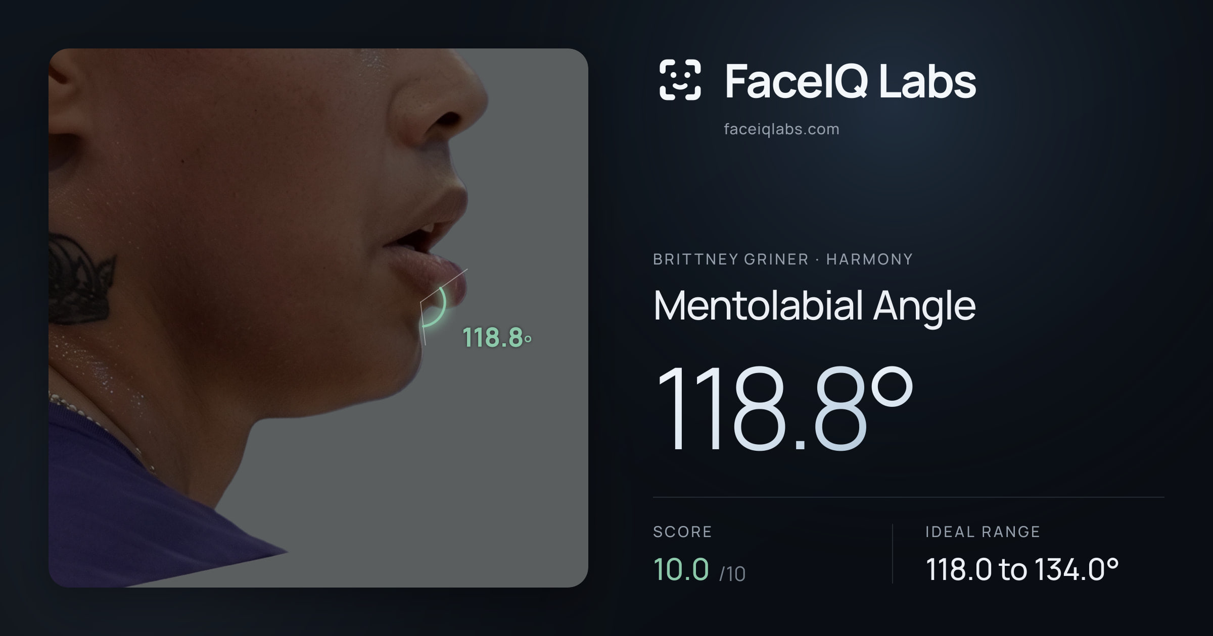 Brittney Griner Mentolabial Angle: 118.8°, drawn on the photo