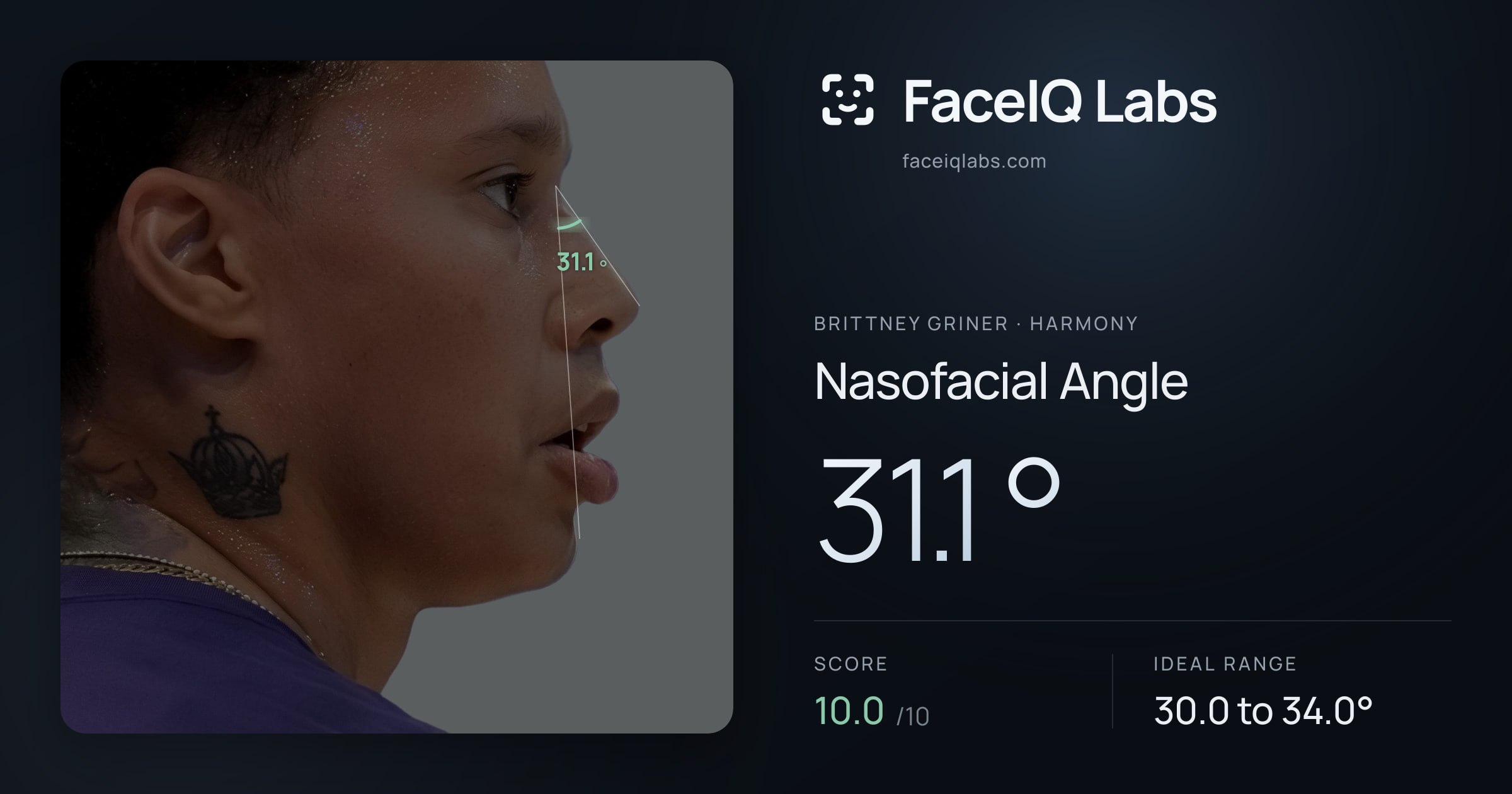 Brittney Griner Nasofacial Angle: 31.1°, drawn on the photo