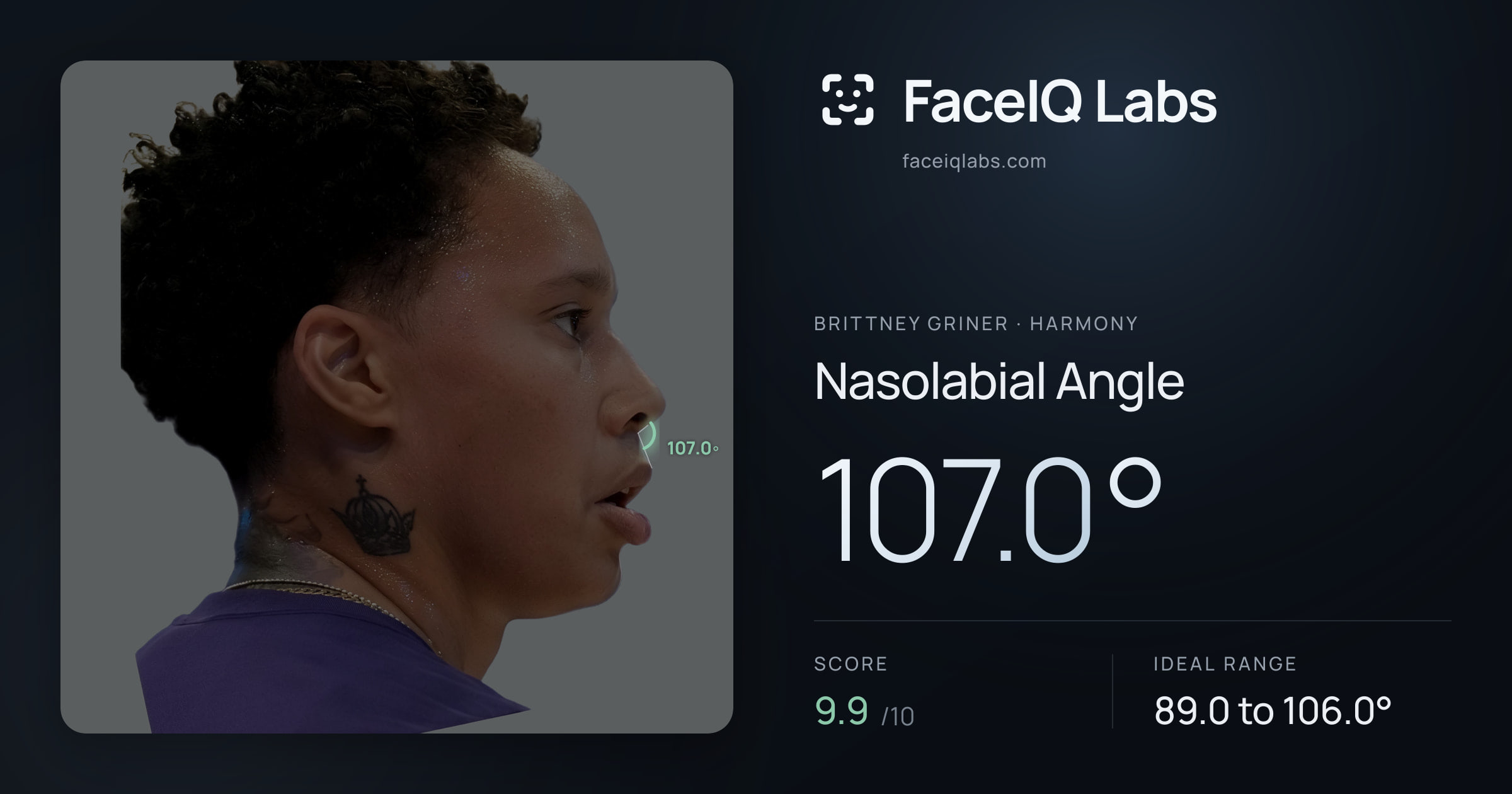 Brittney Griner Nasolabial Angle: 107.0°, drawn on the photo