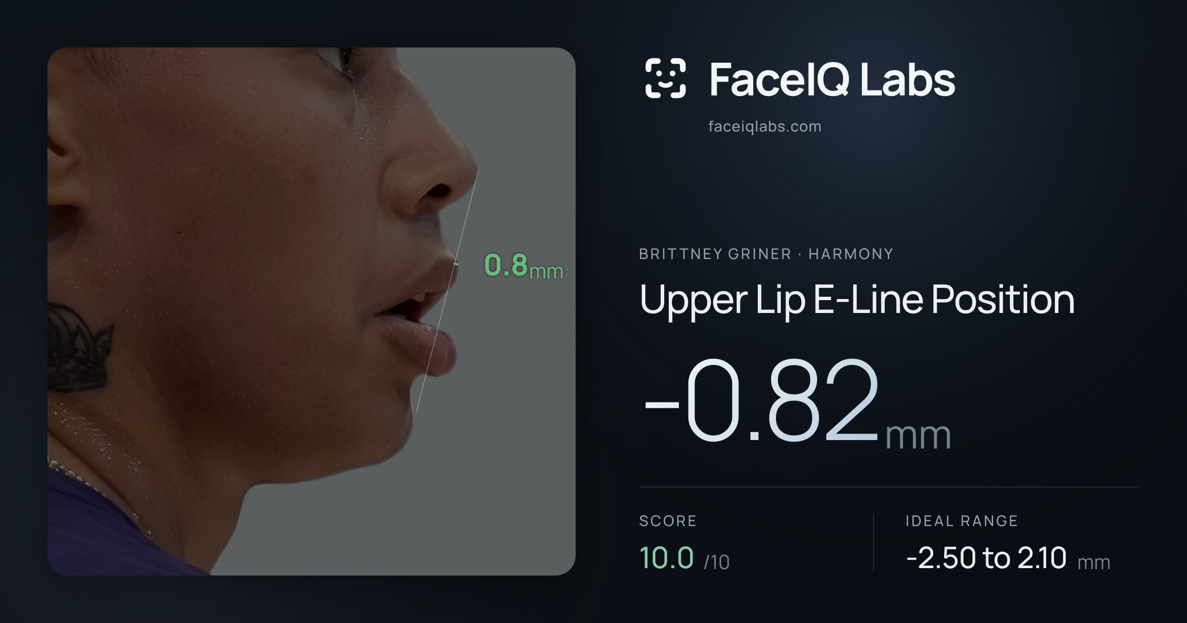 Brittney Griner Upper Lip E-Line Position: -0.82mm, drawn on the photo