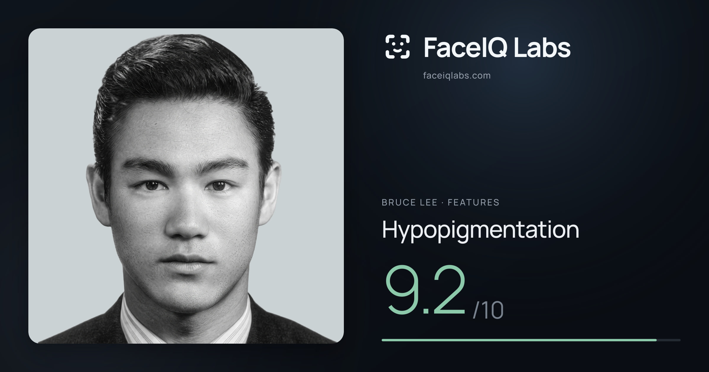 Bruce Lee Hypopigmentation: 9.2/10, drawn on the photo