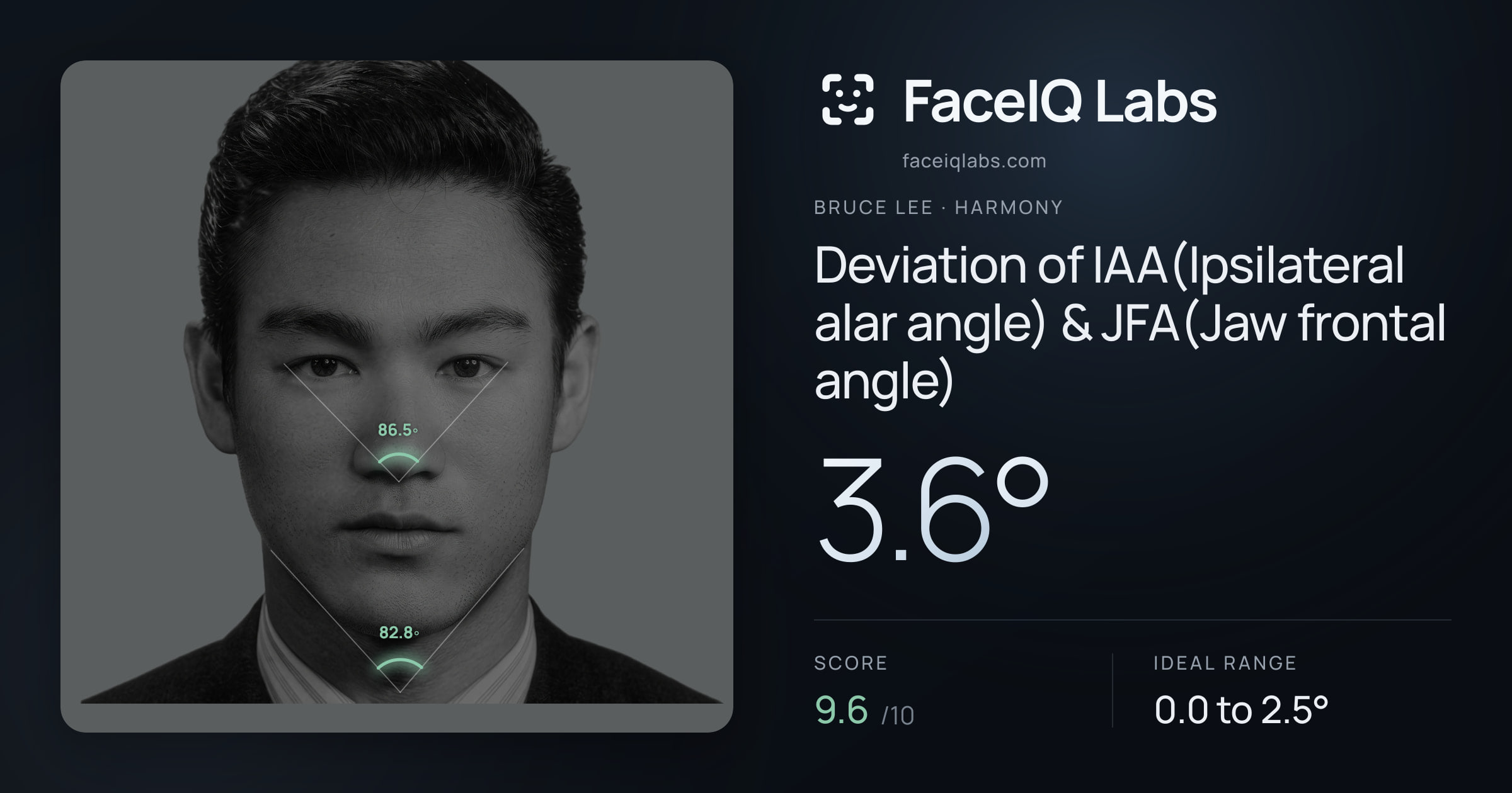 Bruce Lee Deviation of IAA(Ipsilateral alar angle) & JFA(Jaw frontal angle): 3.6°, drawn on the photo