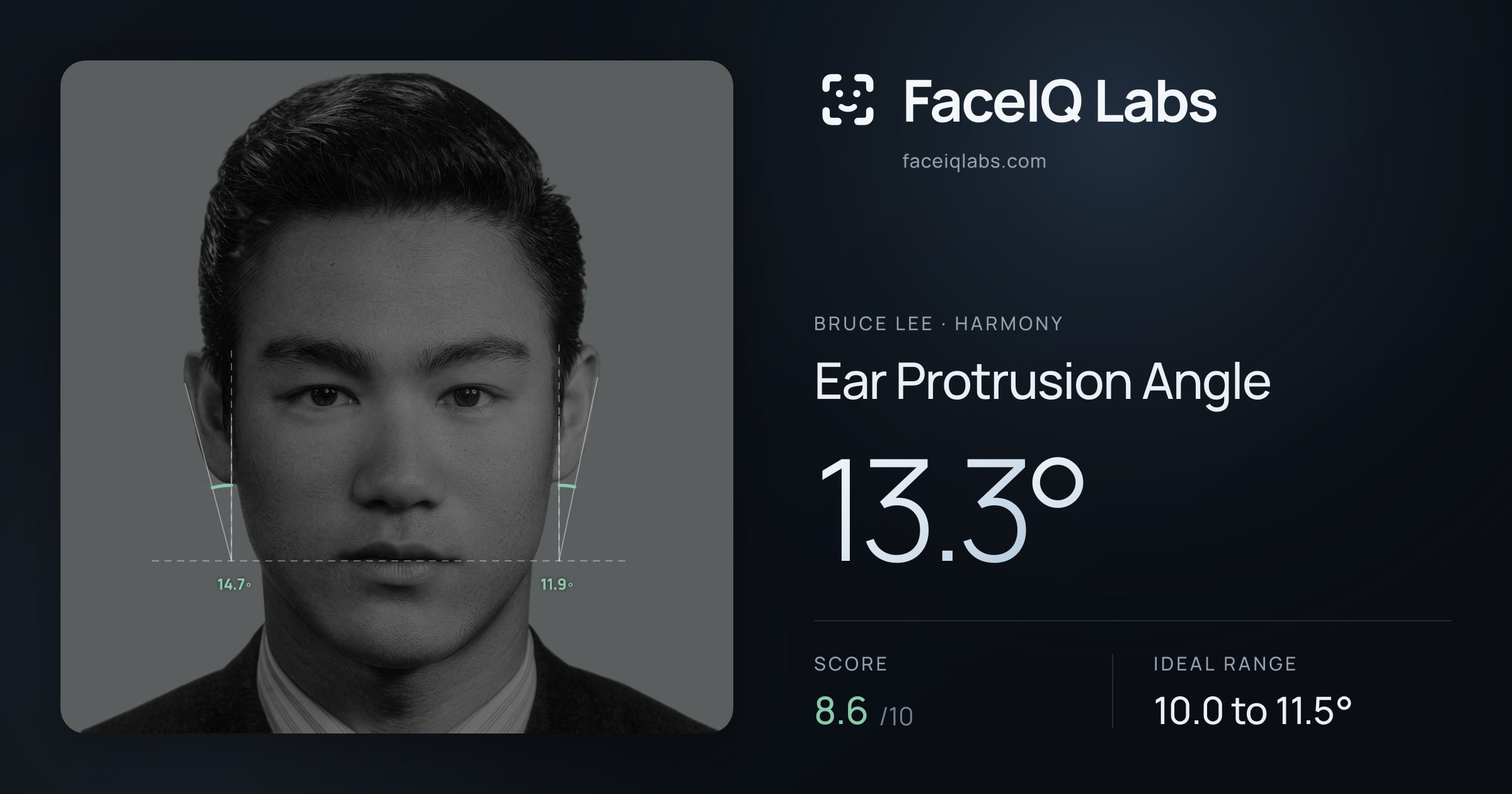 Bruce Lee Ear Protrusion Angle: 13.3°, drawn on the photo