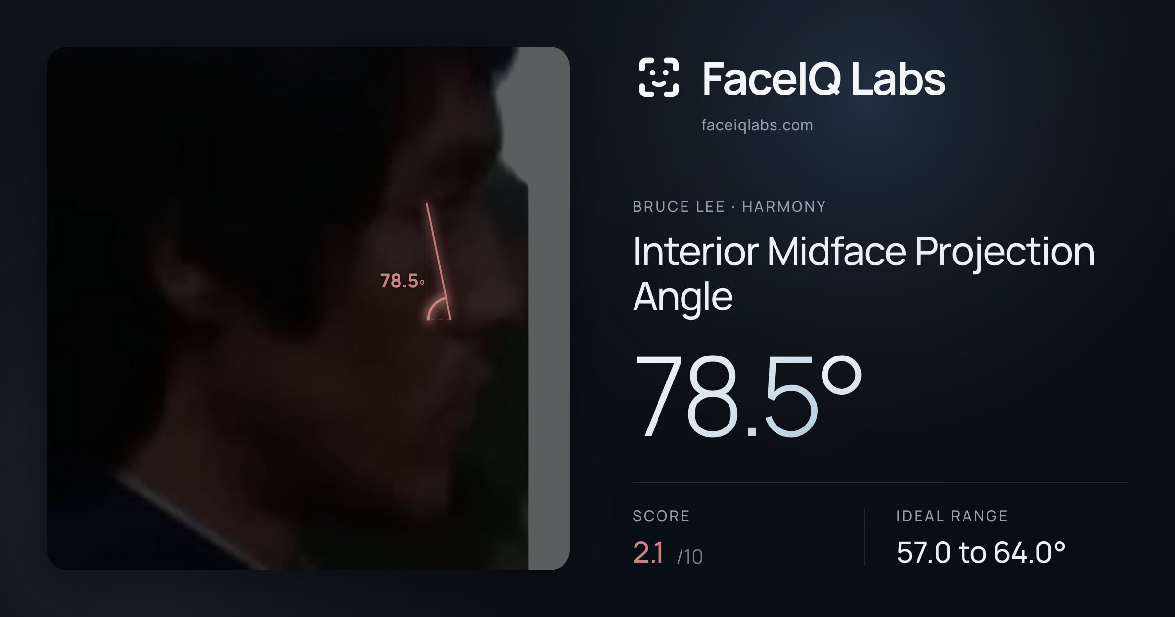 Bruce Lee Interior Midface Projection Angle: 78.5°, drawn on the photo