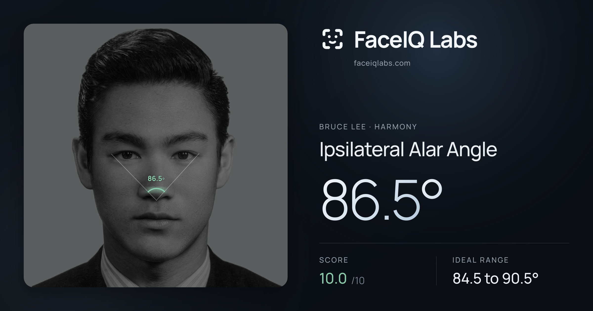 Bruce Lee Ipsilateral Alar Angle: 86.5°, drawn on the photo