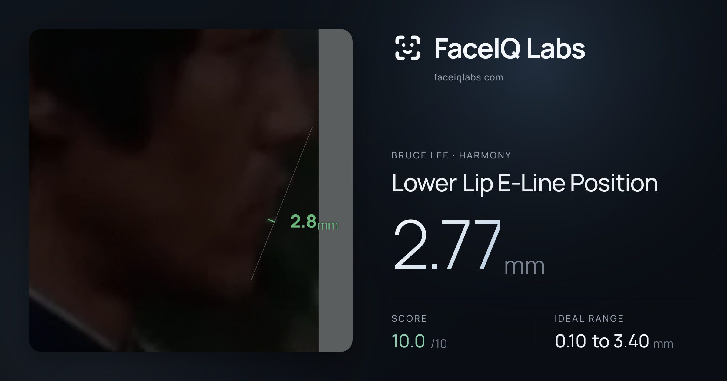 Bruce Lee Lower Lip E-Line Position: 2.77mm, drawn on the photo