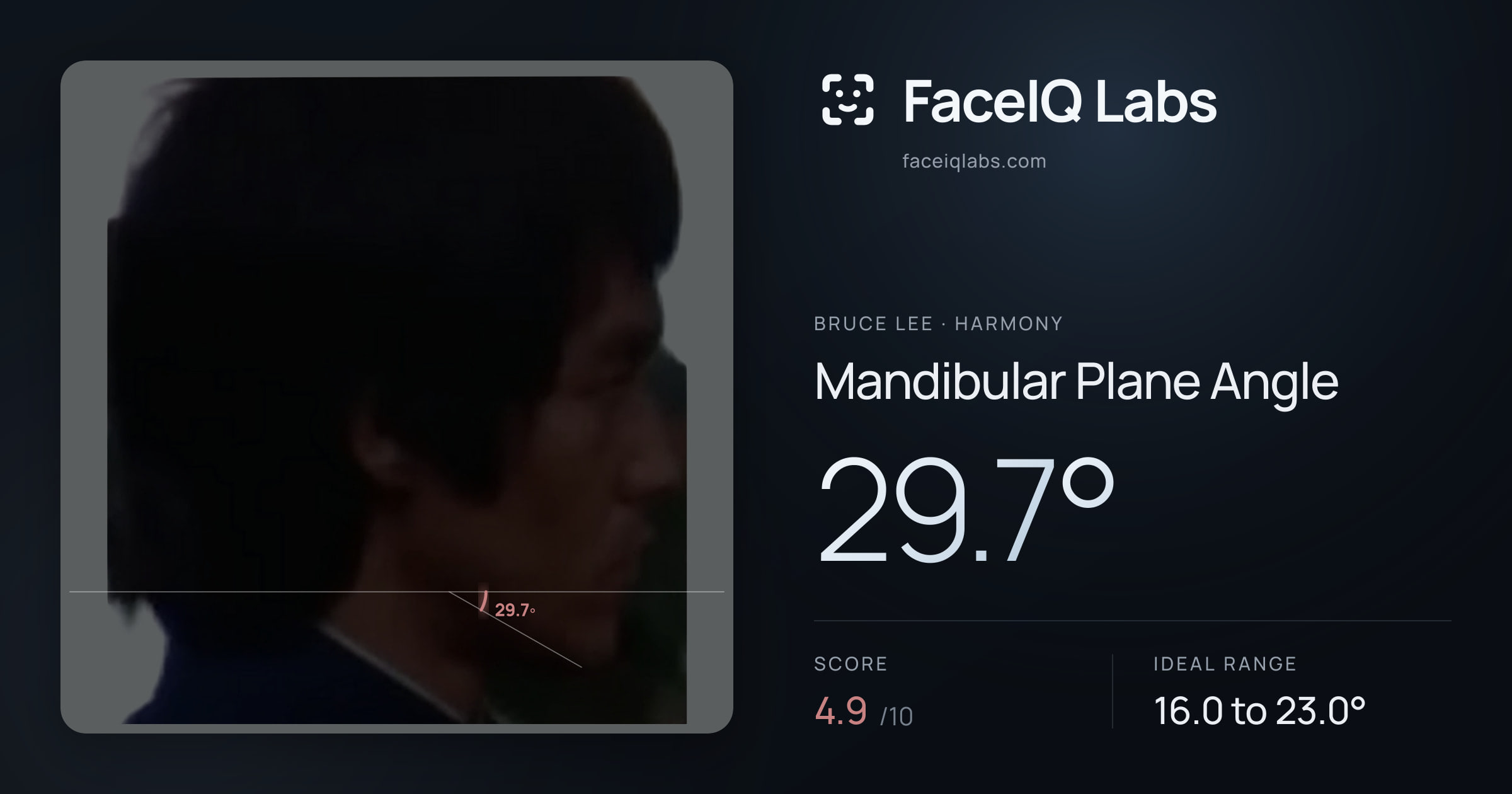 Bruce Lee Mandibular Plane Angle: 29.7°, drawn on the photo