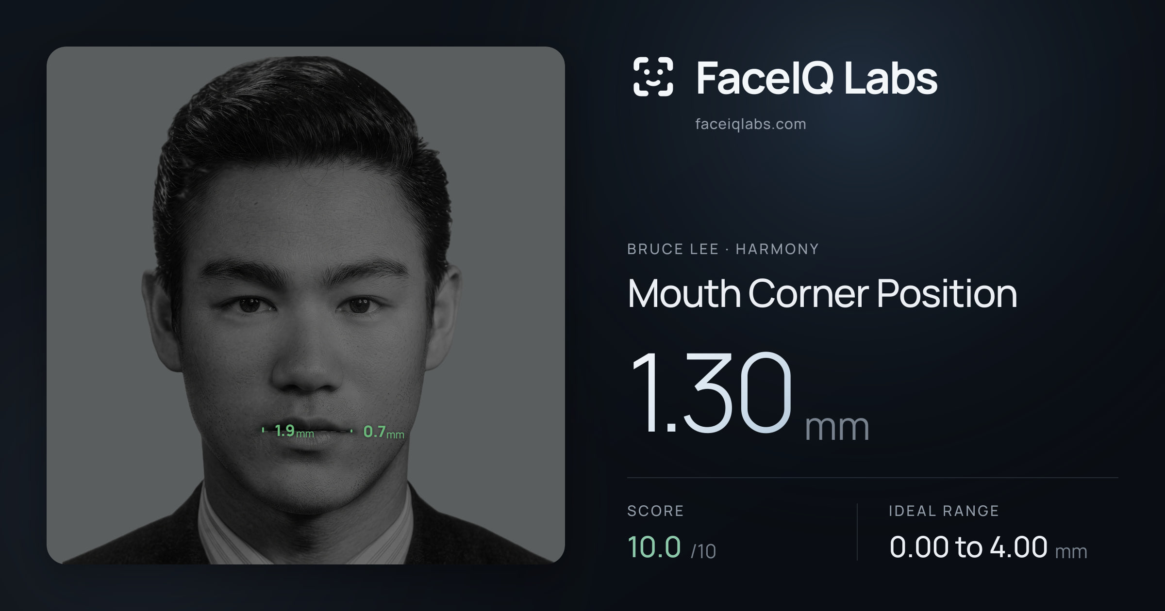 Bruce Lee Mouth Corner Position: 1.30mm, drawn on the photo