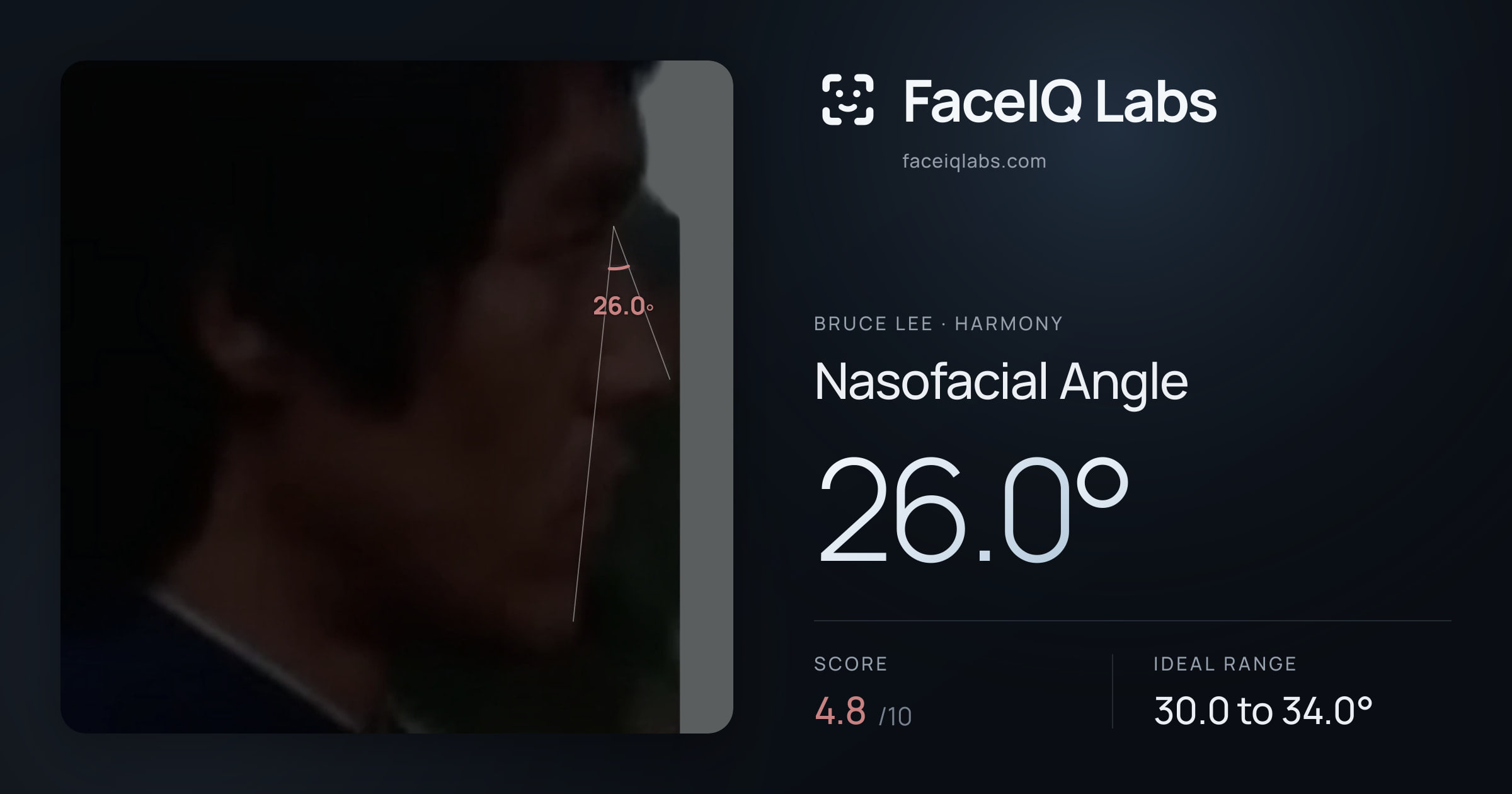 Bruce Lee Nasofacial Angle: 26.0°, drawn on the photo