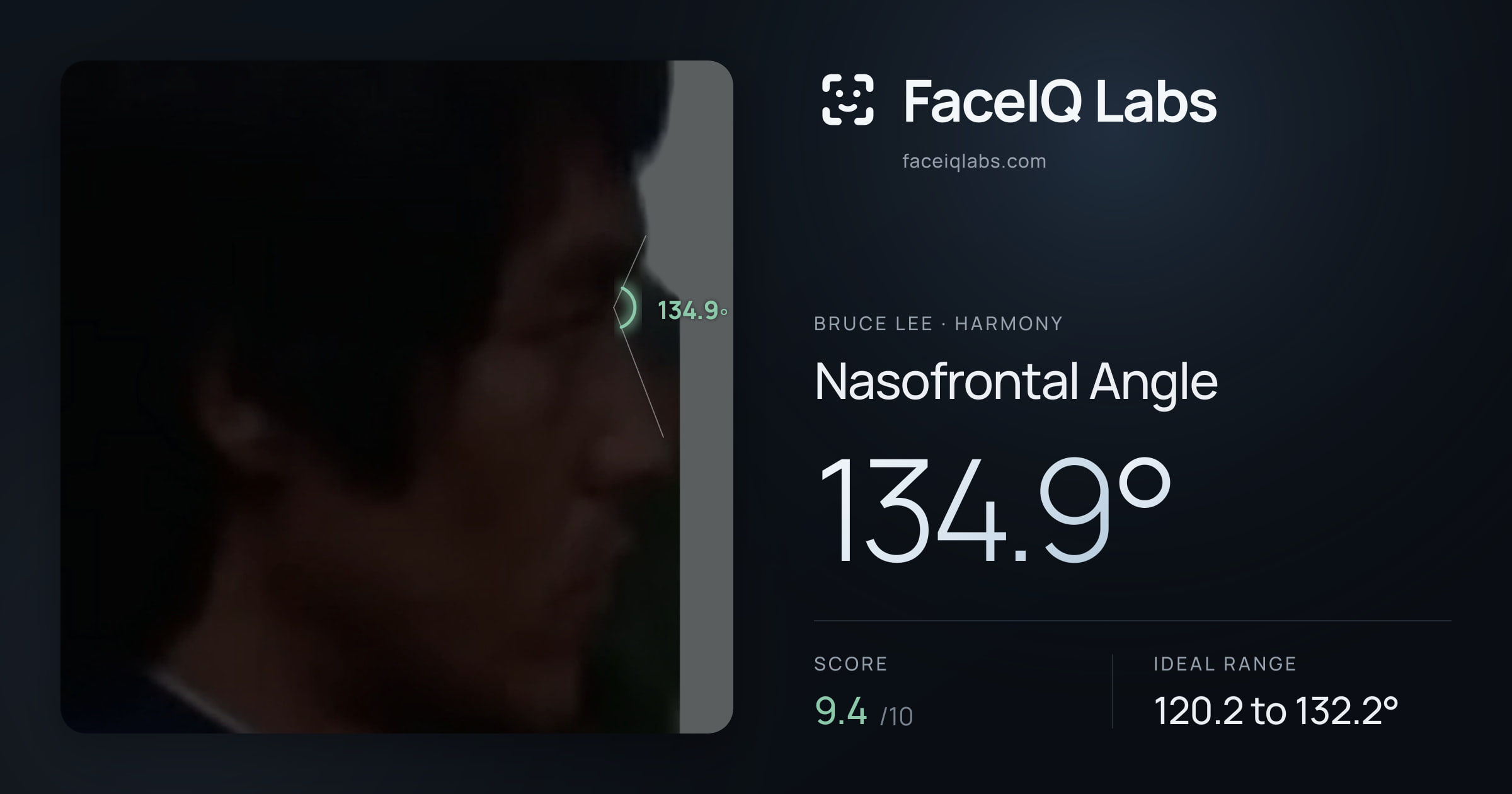Bruce Lee Nasofrontal Angle: 134.9°, drawn on the photo