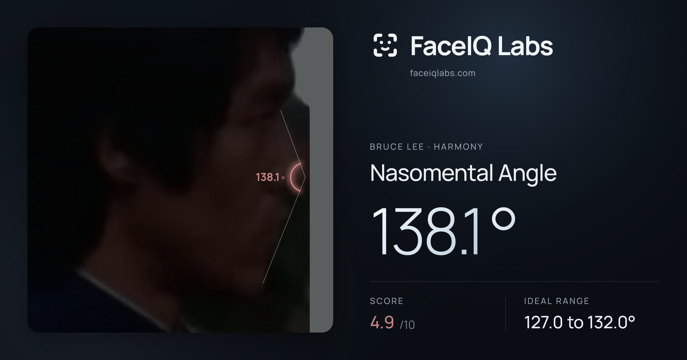 Bruce Lee Nasomental Angle: 138.1°, drawn on the photo