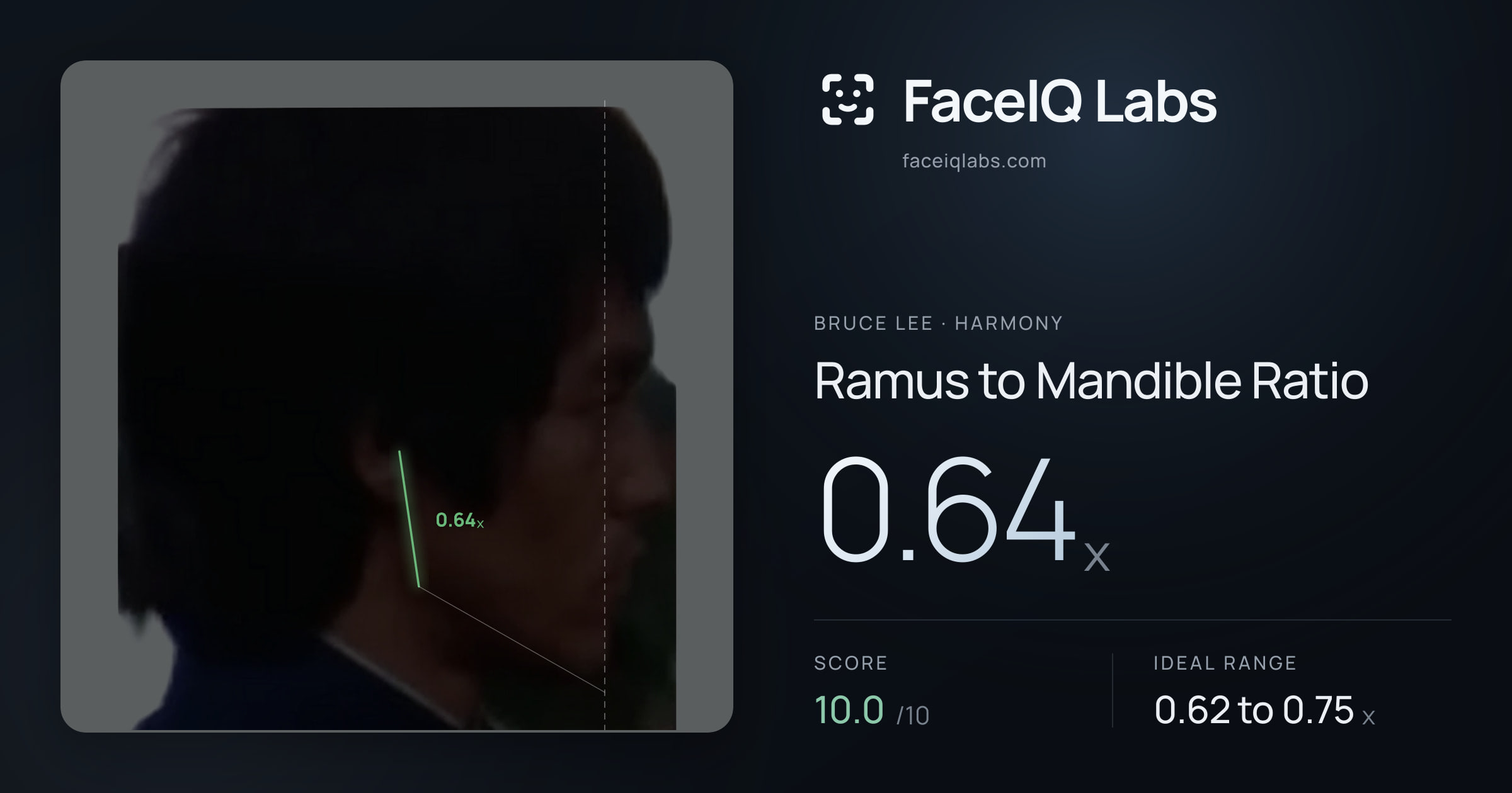 Bruce Lee Ramus to Mandible Ratio: 0.64x, drawn on the photo